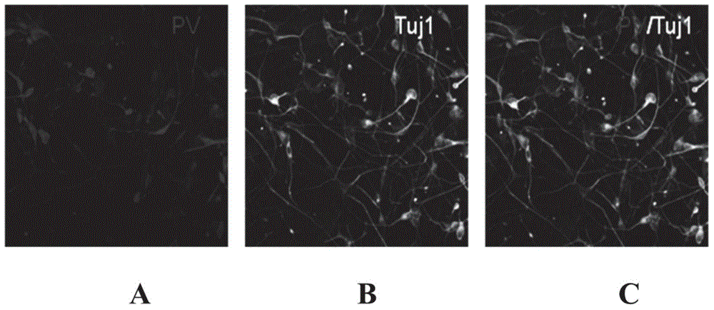 Method for inducing fibroblasts into neuronal cells by transdifferentiation and application of fibroblasts