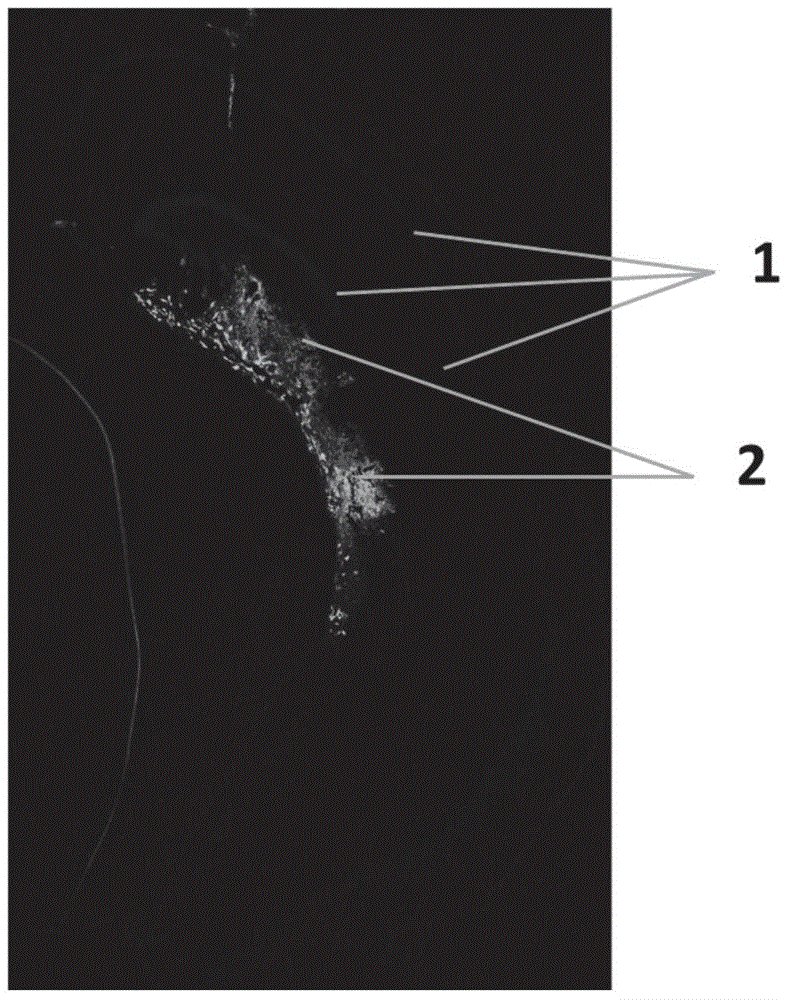 Method for inducing fibroblasts into neuronal cells by transdifferentiation and application of fibroblasts