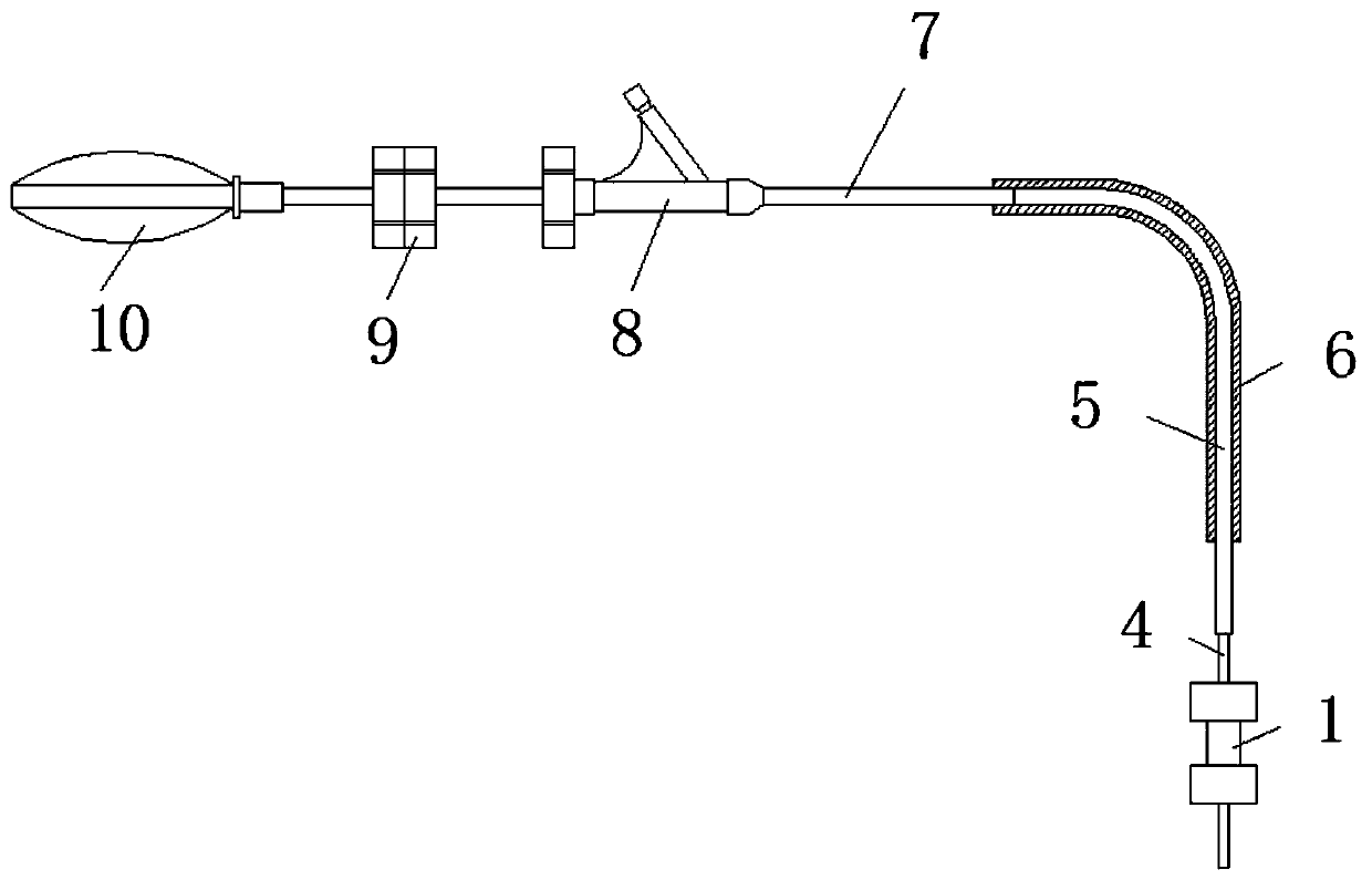 An extrahepatic vascular anastomosis stent and its delivery system