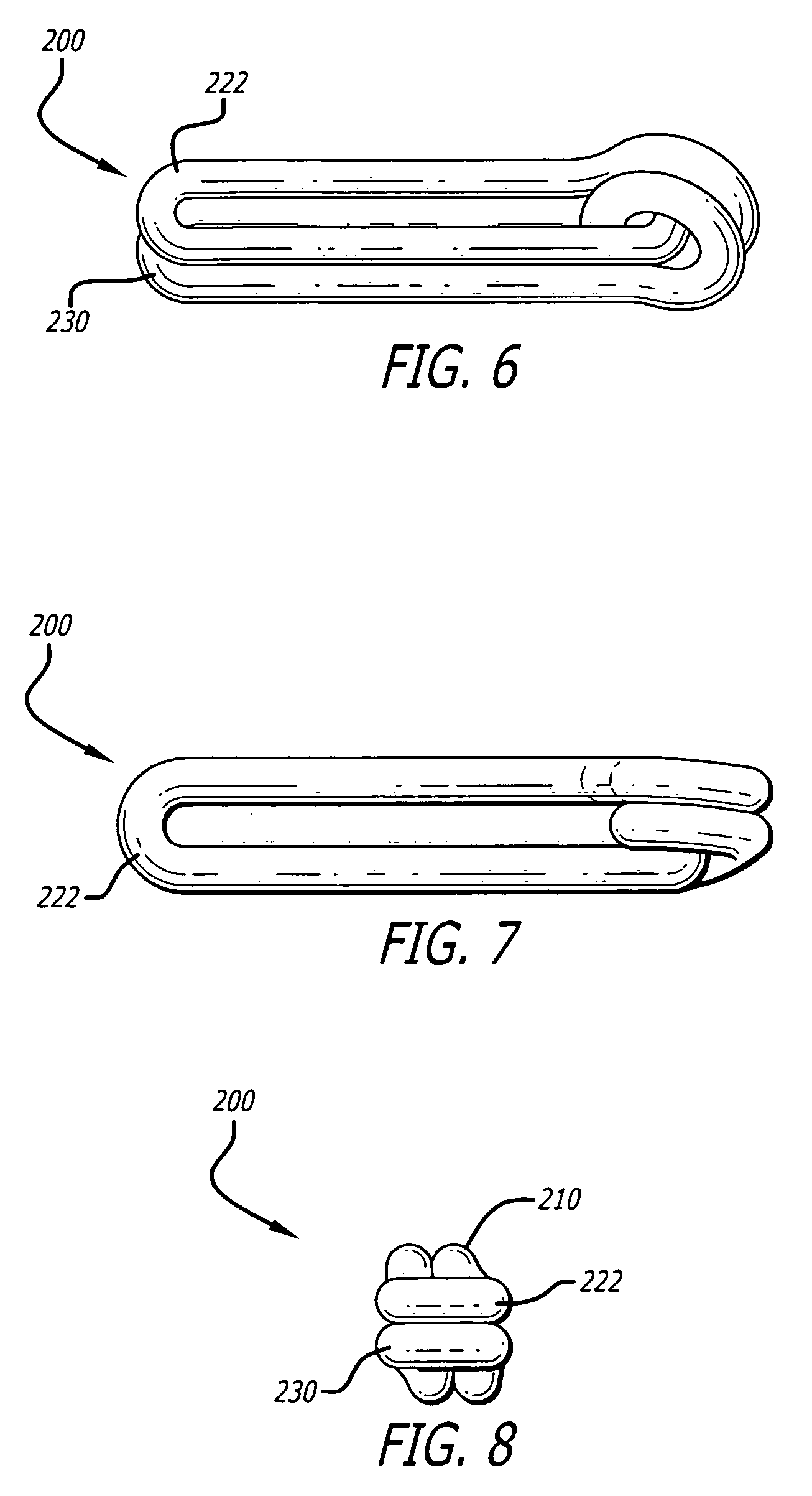 Surgical ligation clip