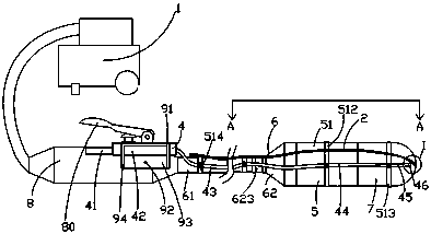 Operation repositor having external endoscope and being used for left displacement of abomasum of cow