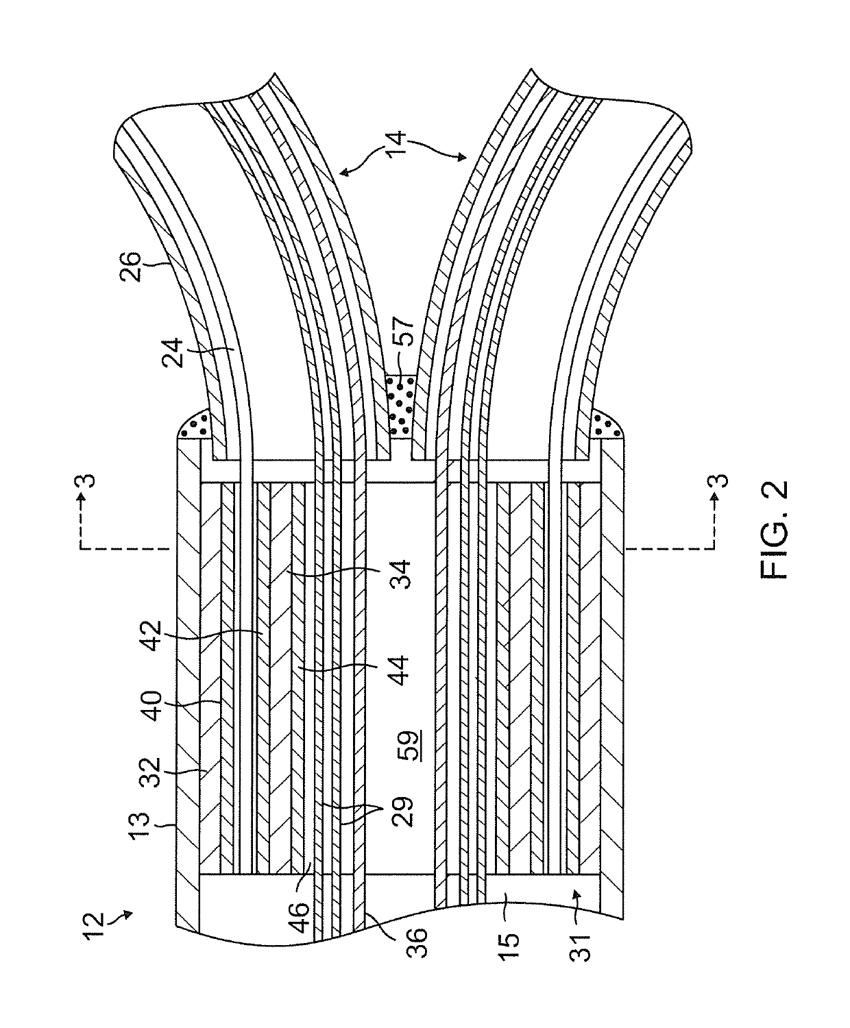 Catheter with multiple spines of different lengths arranged in one or more distal assemblies