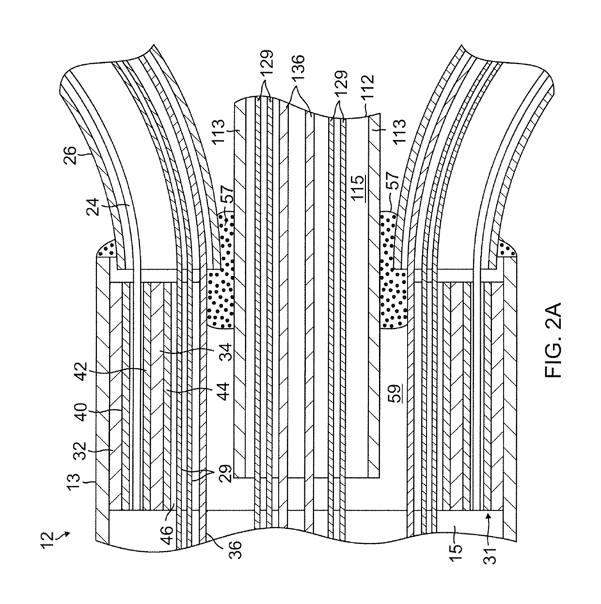 Catheter with multiple spines of different lengths arranged in one or more distal assemblies