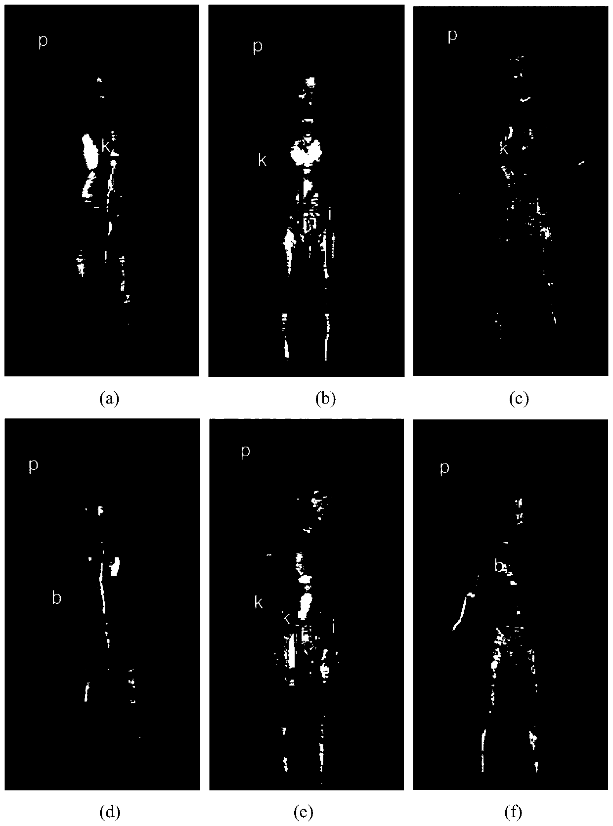 A small sample terahertz image foreign matter detection method based on integrated deep learning