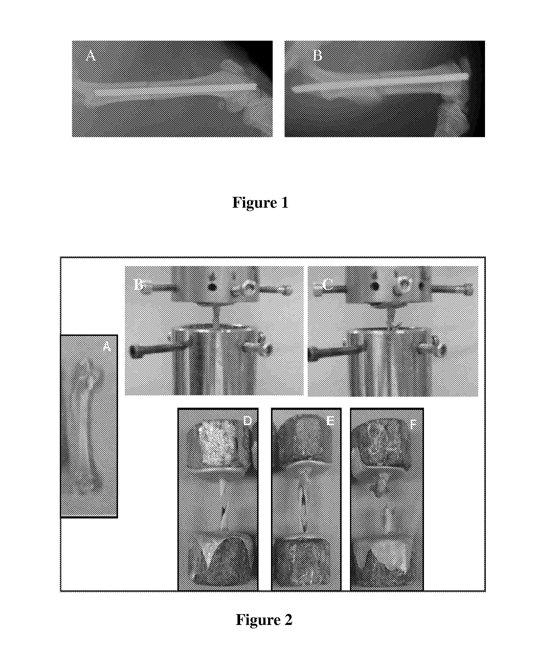 Implantable devices coated with insulin-mimetic vanadium compounds and methods thereof