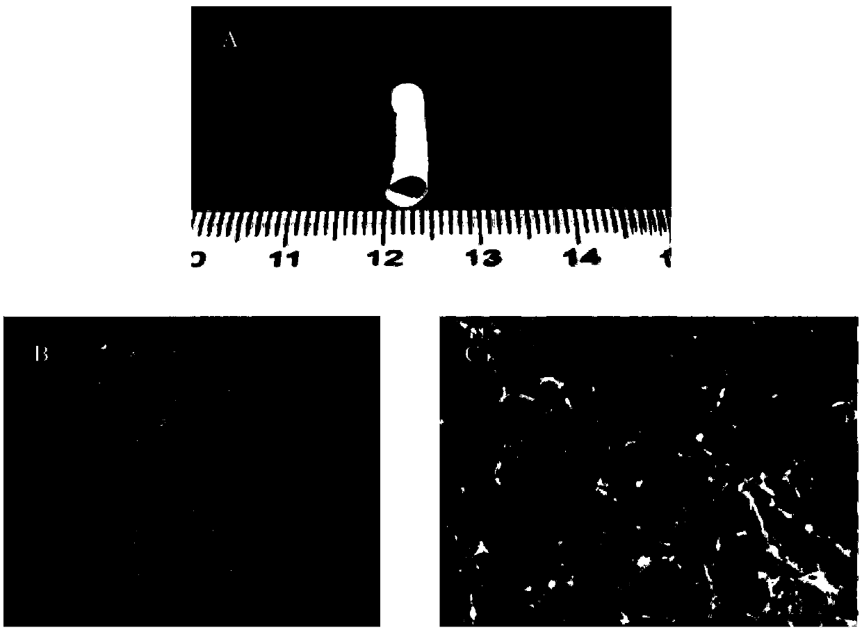 Tissue engineering double-layered tubular support and preparation method thereof