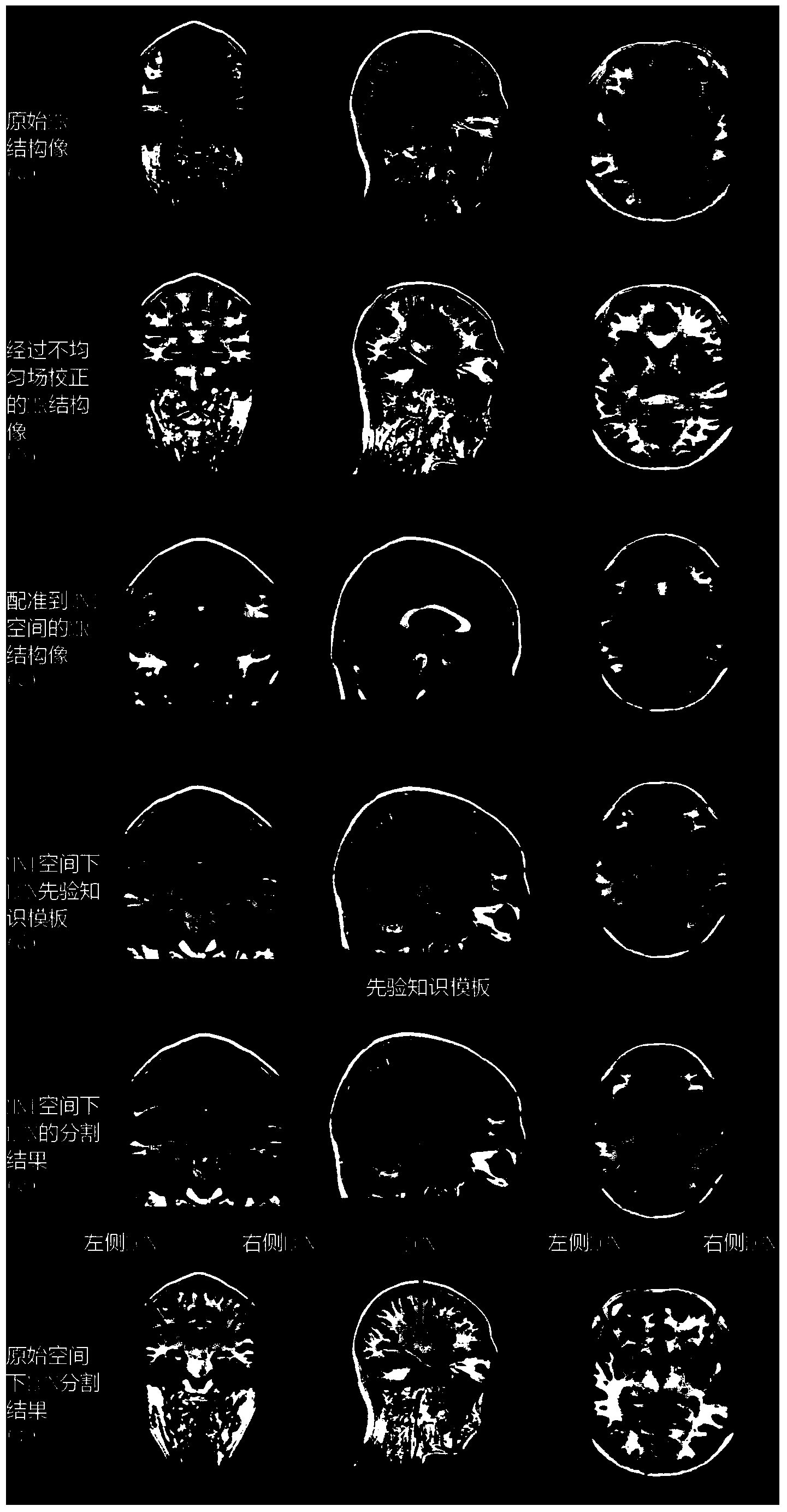 Method for automatically segmenting human lateral geniculate nucleus through prior knowledge