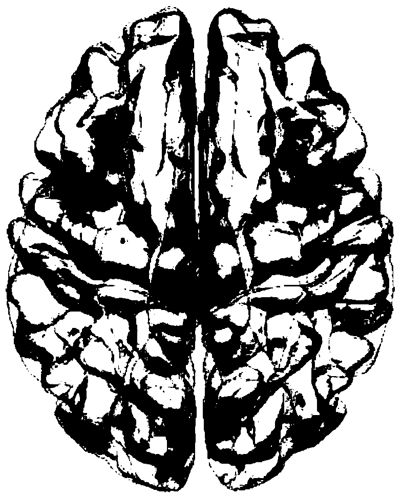 Method for automatically segmenting human lateral geniculate nucleus through prior knowledge