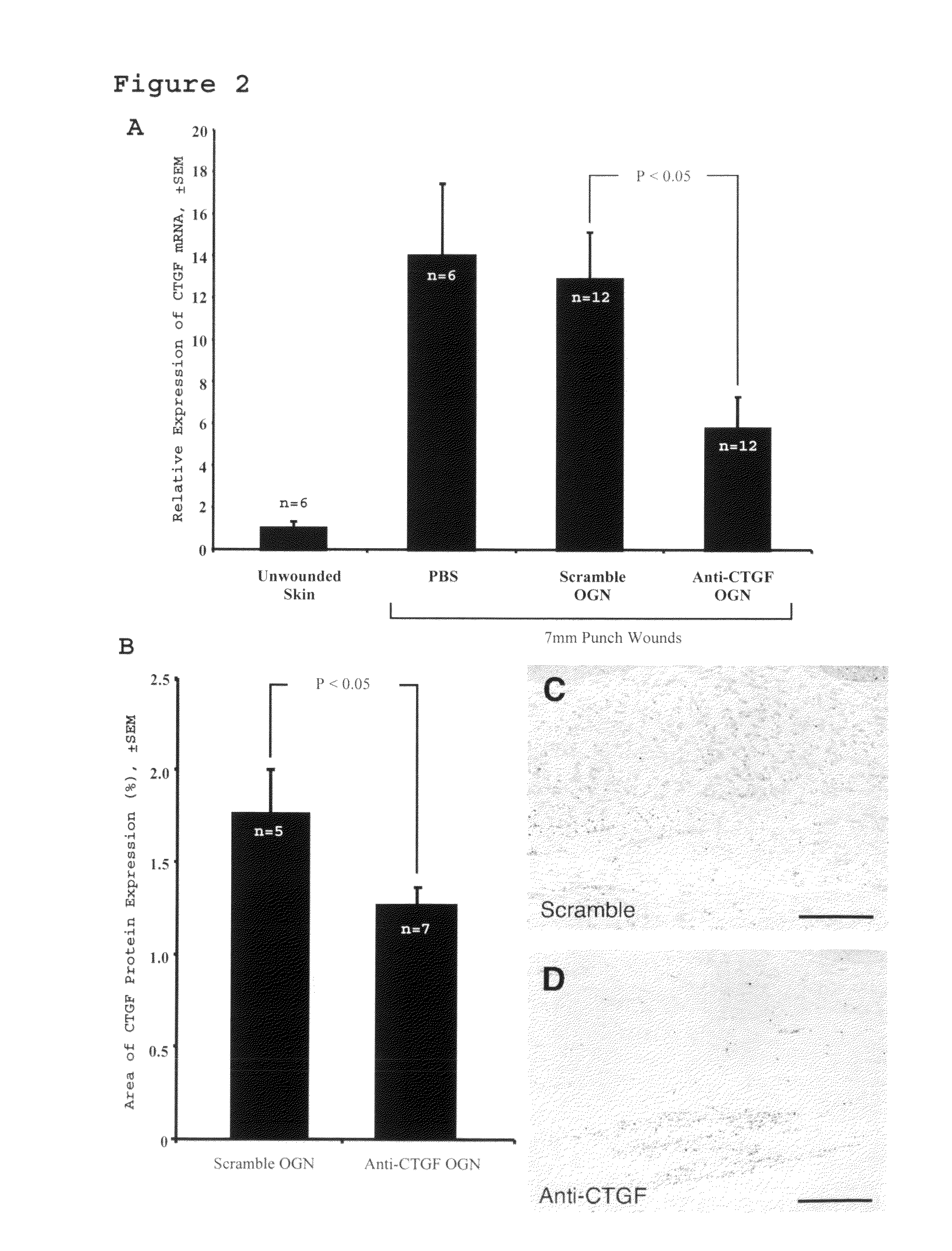 Method for reducing scarring during wound healing using antisense compounds directed to CTGF