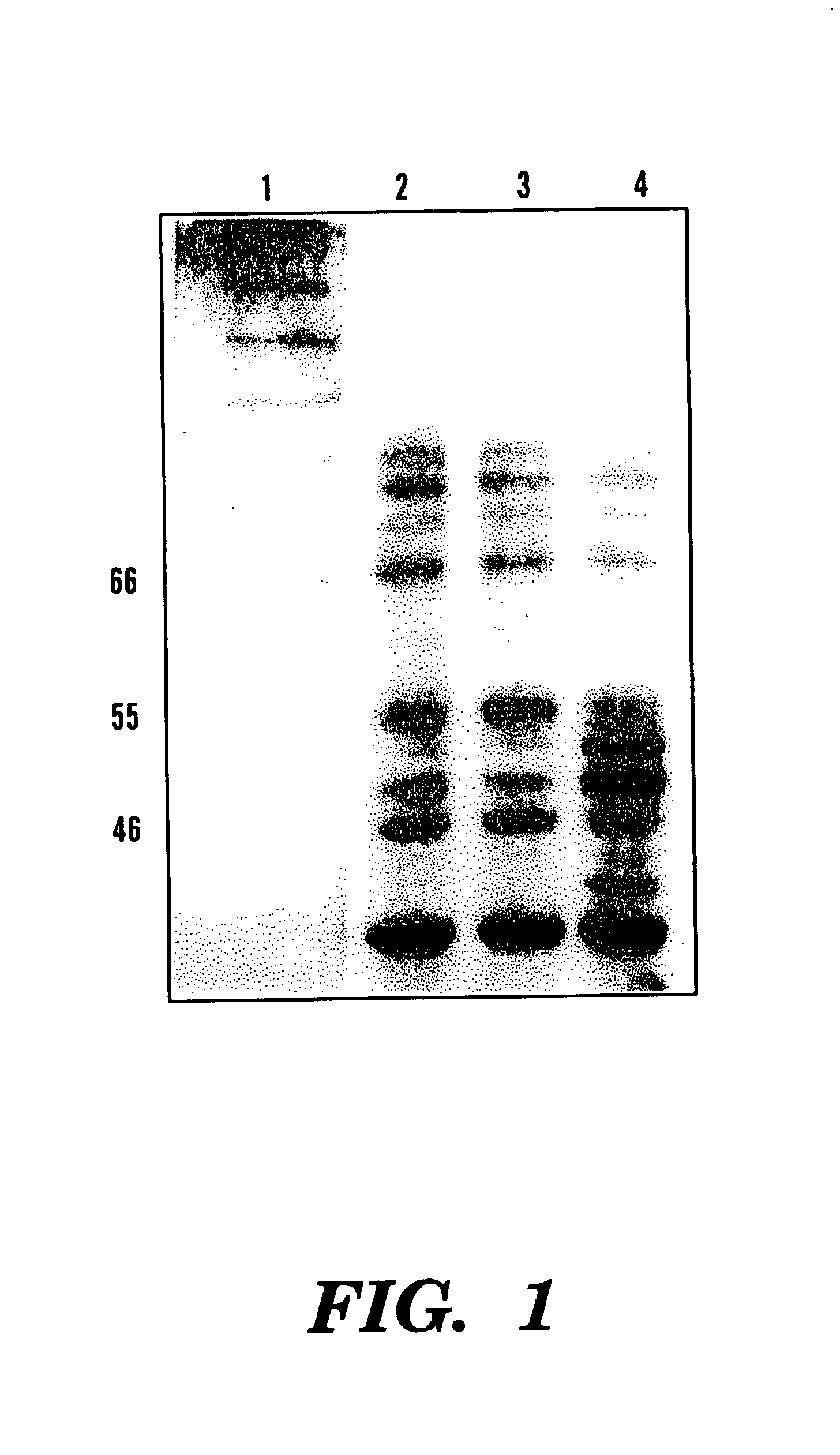 Overexpression of phytase genes in yeast systems