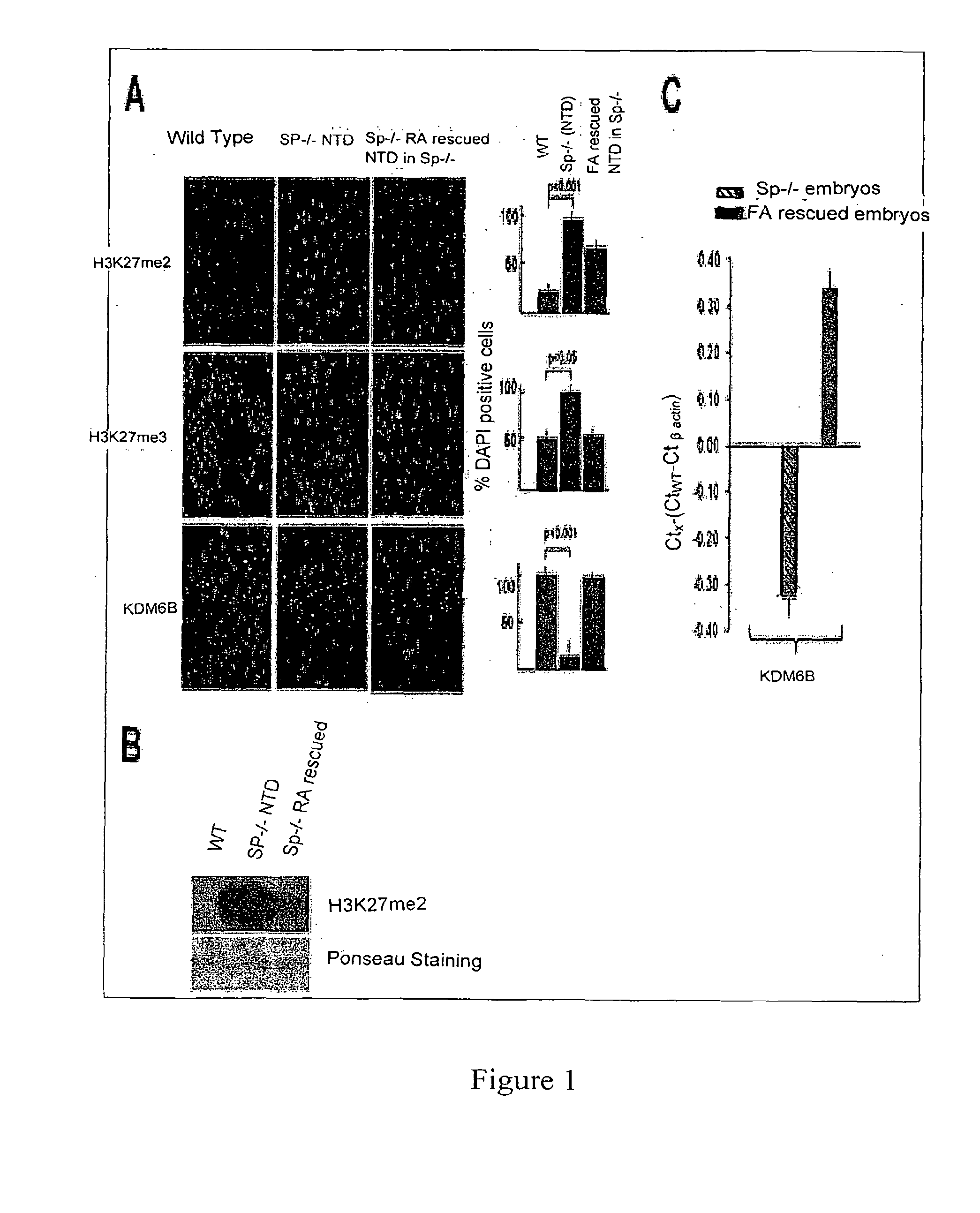 Method of Detecting and Profiling Progression of the Risk of Neurodegenerative Diseases