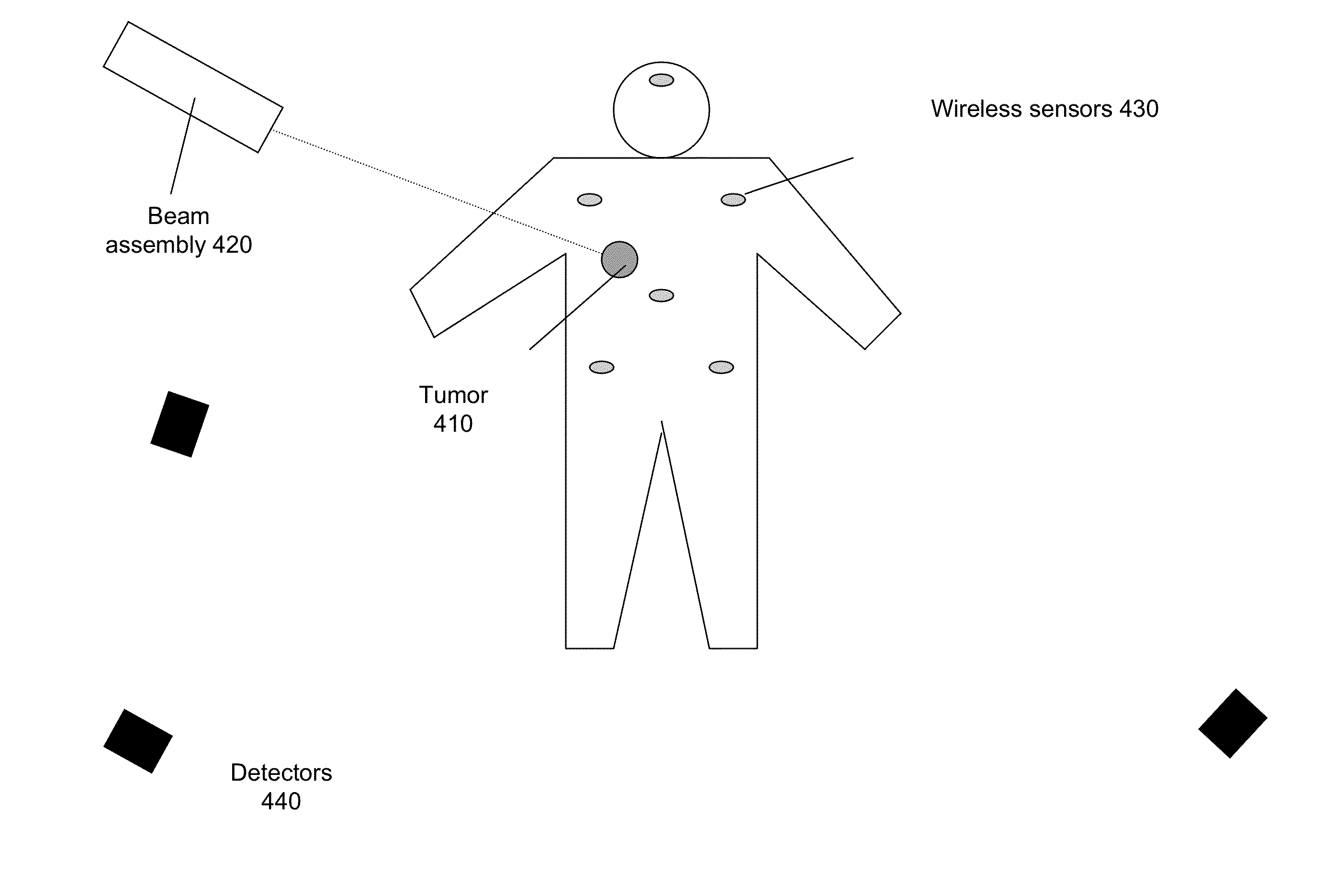 Tracking of tumor location for targeted radiation treatment