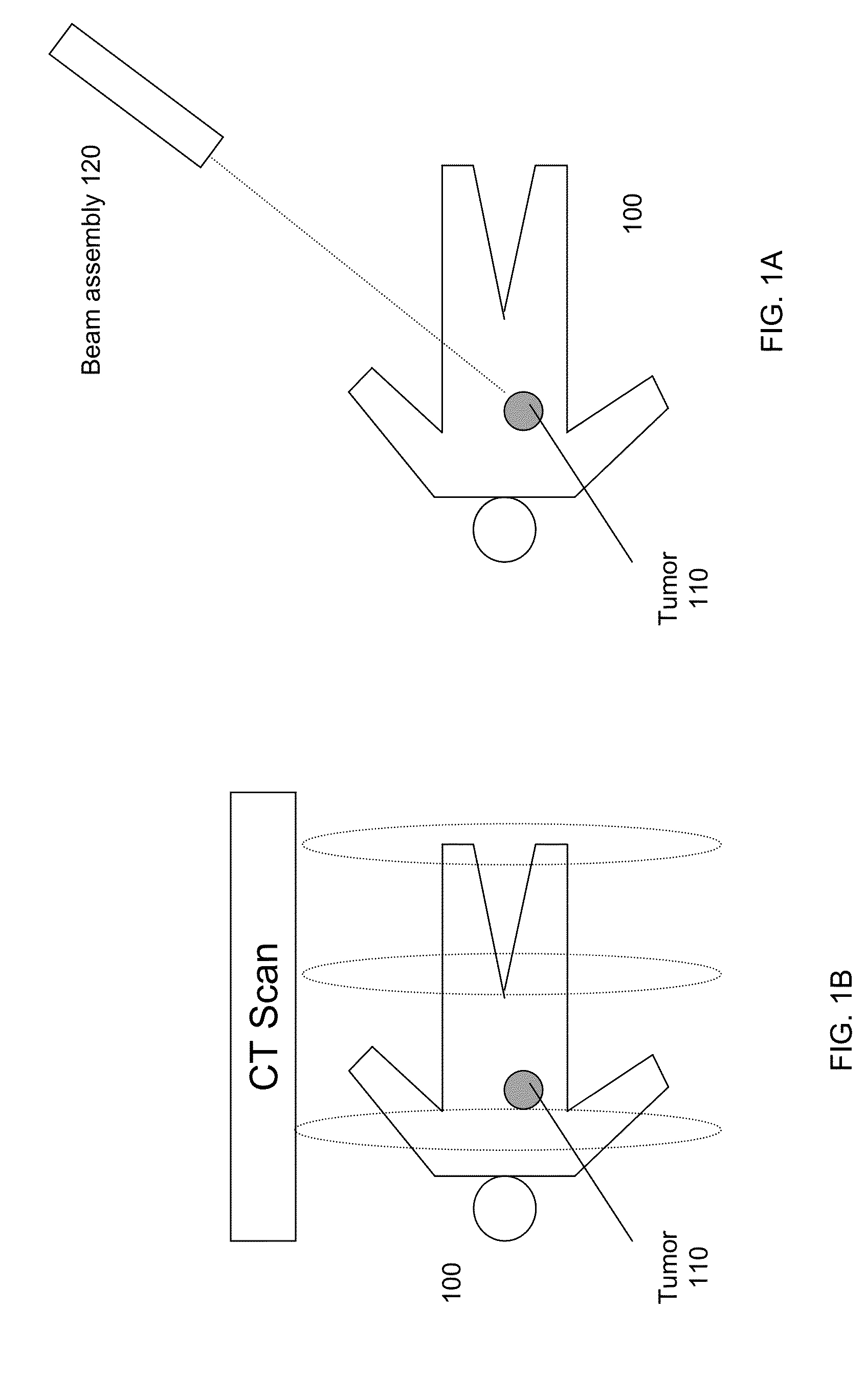 Tracking of tumor location for targeted radiation treatment