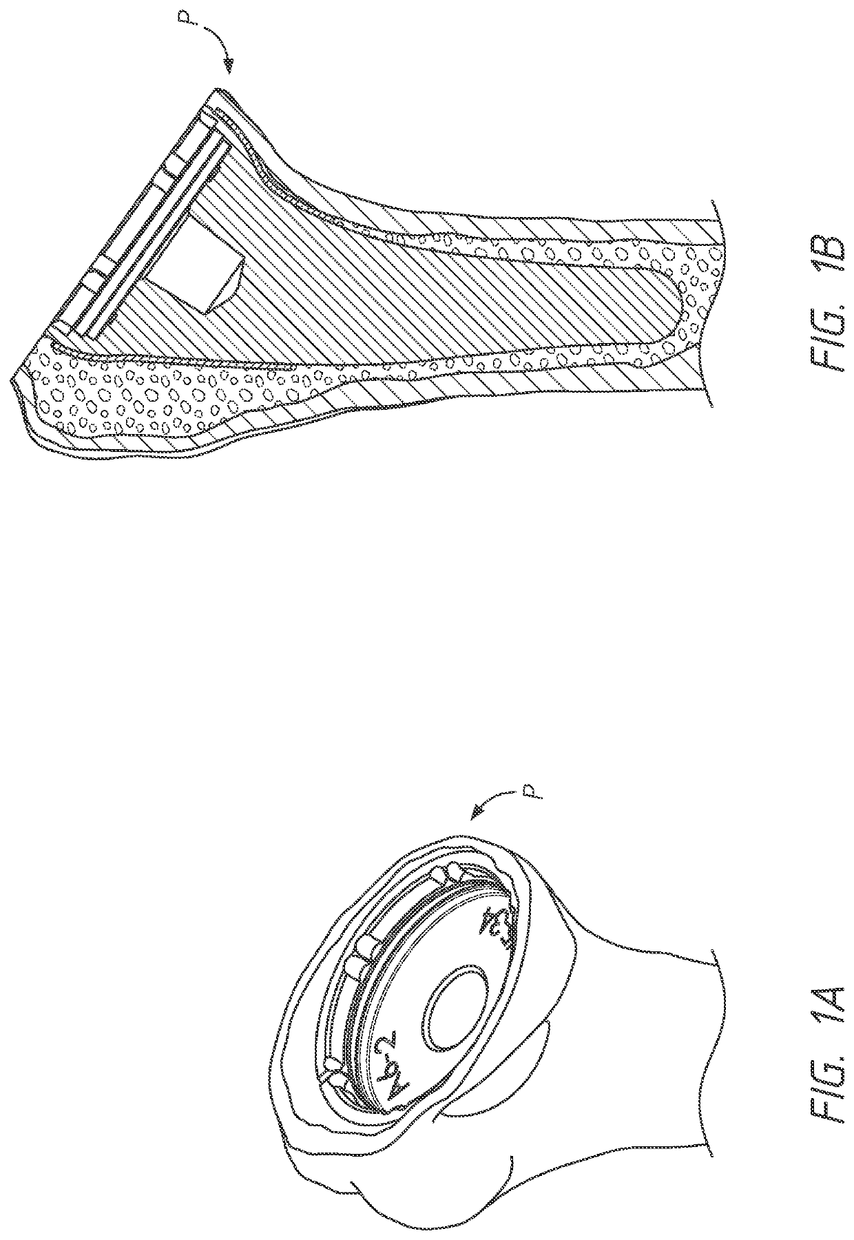 Metaphyseal referencing technique and instrument