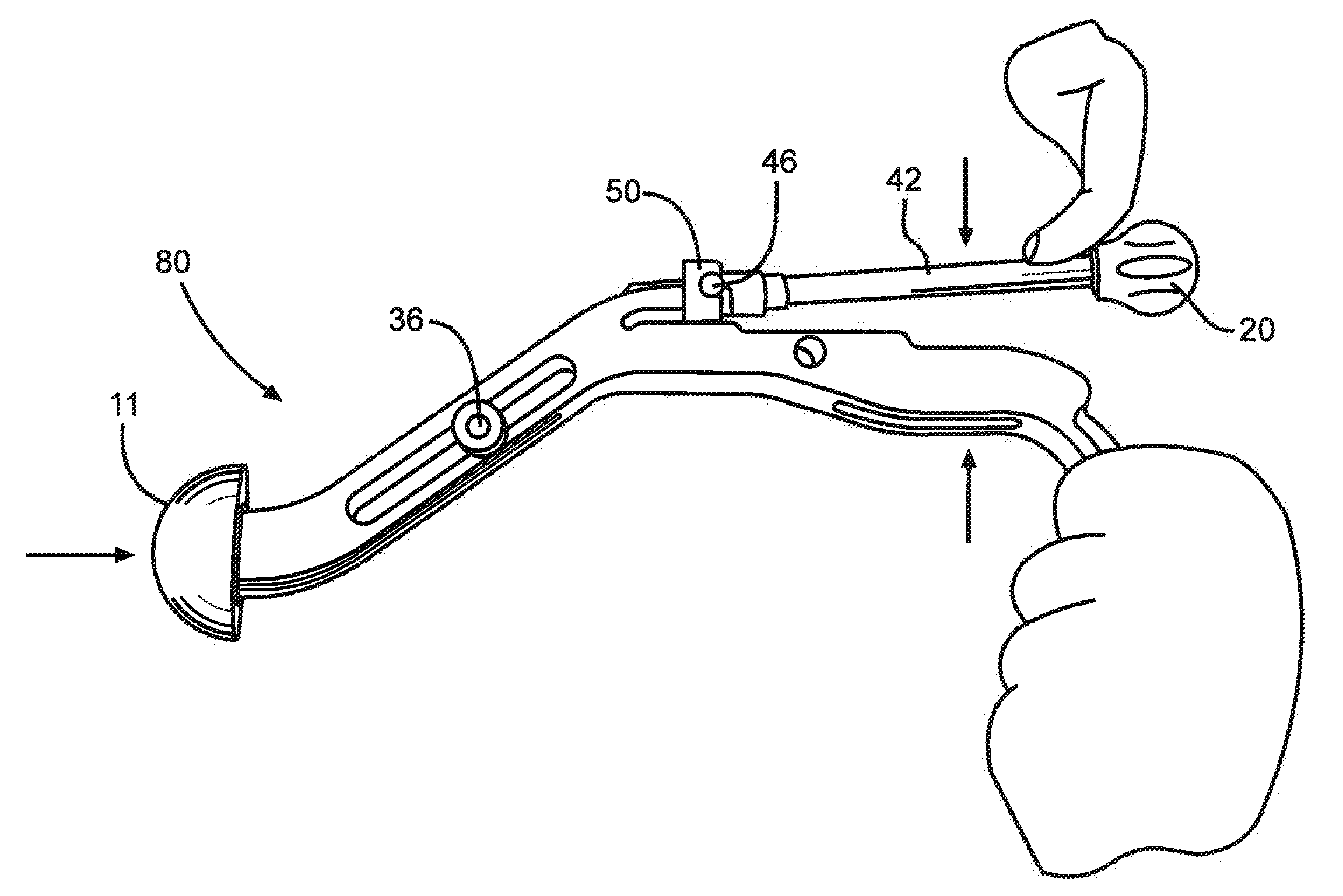 Inserter For Minimally Invasive Joint Surgery Having an Interchangeable Prosthesis Engaging Piston