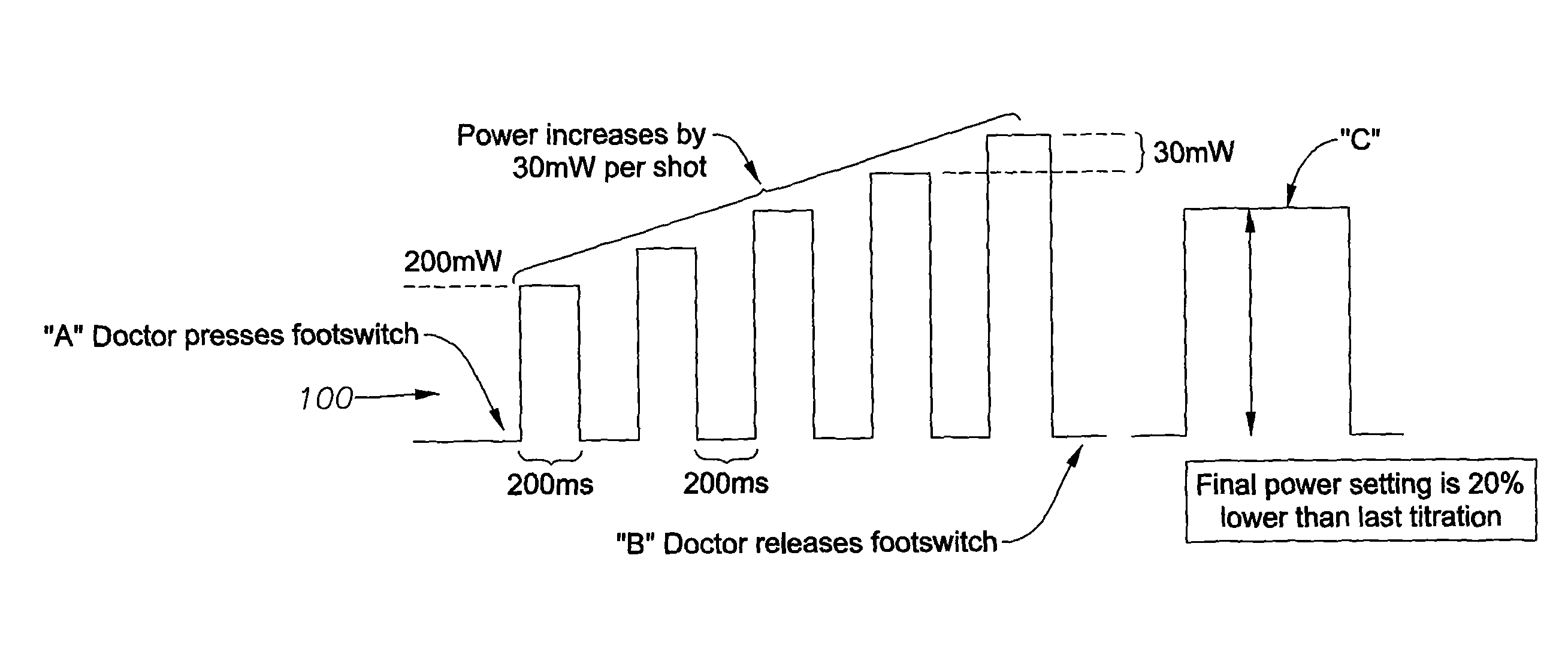 Apparatus and method for auto-titrating a laser