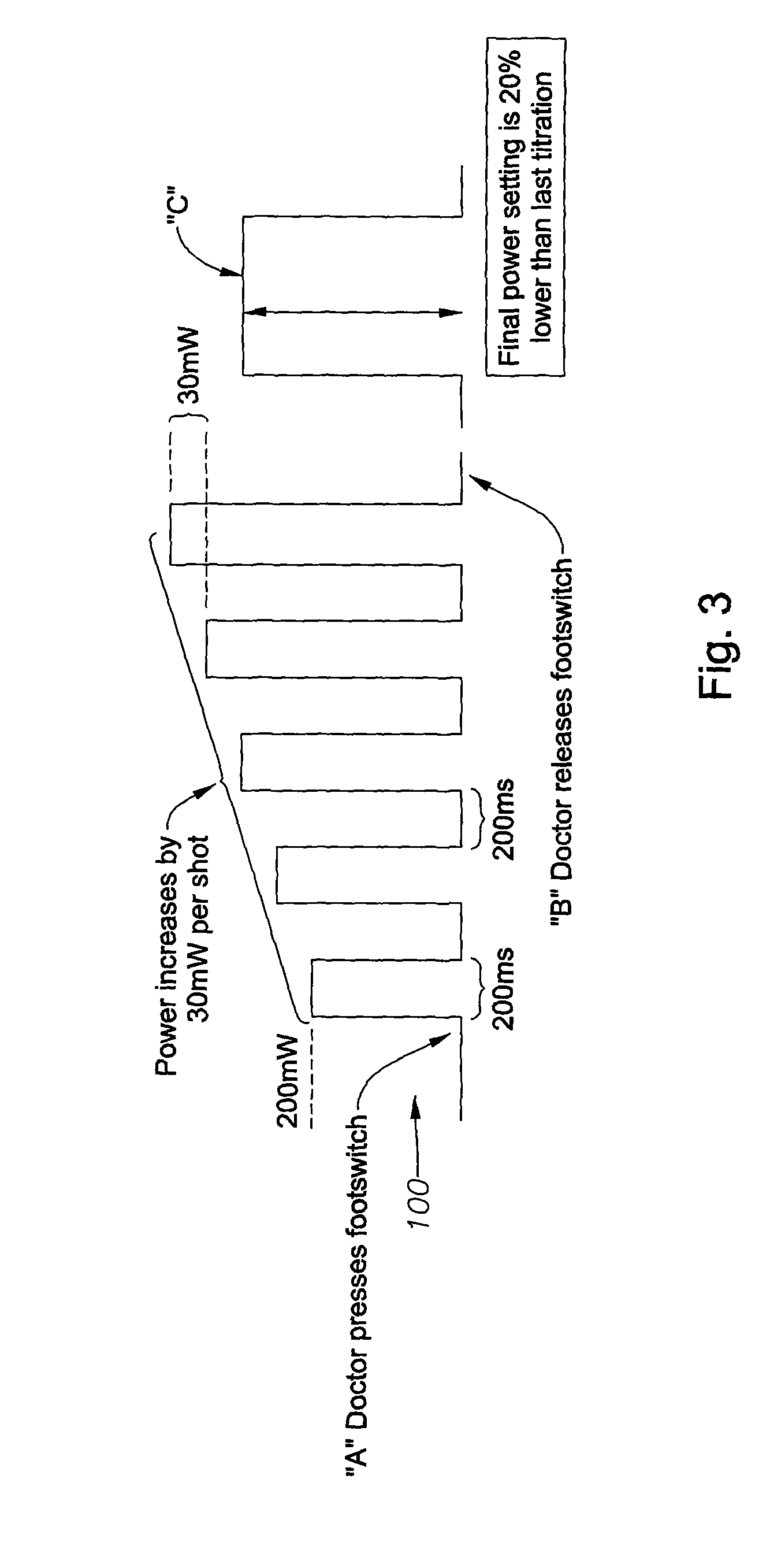 Apparatus and method for auto-titrating a laser