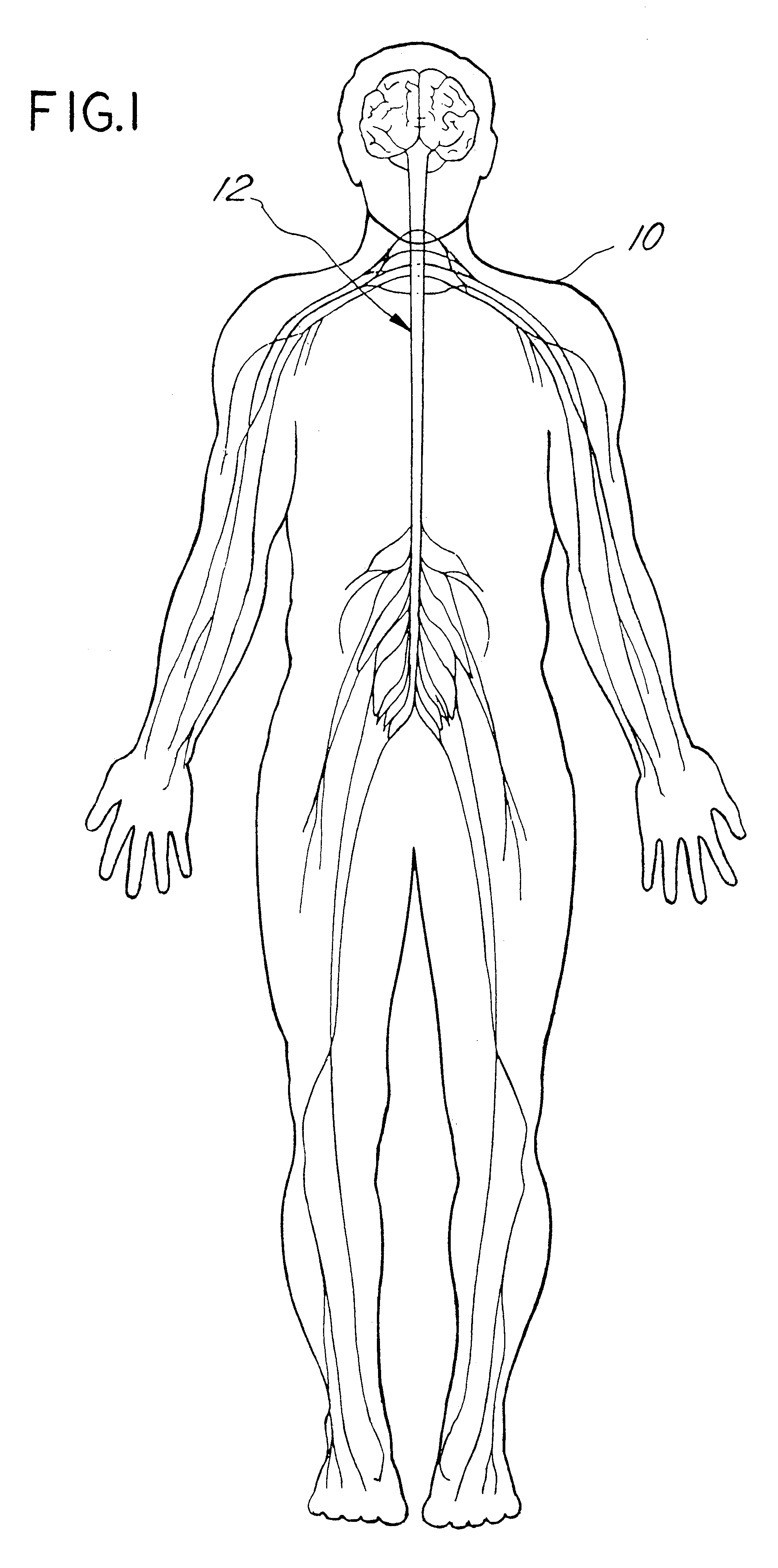 Apparatus and method for percutaneous implant of a paddle style lead