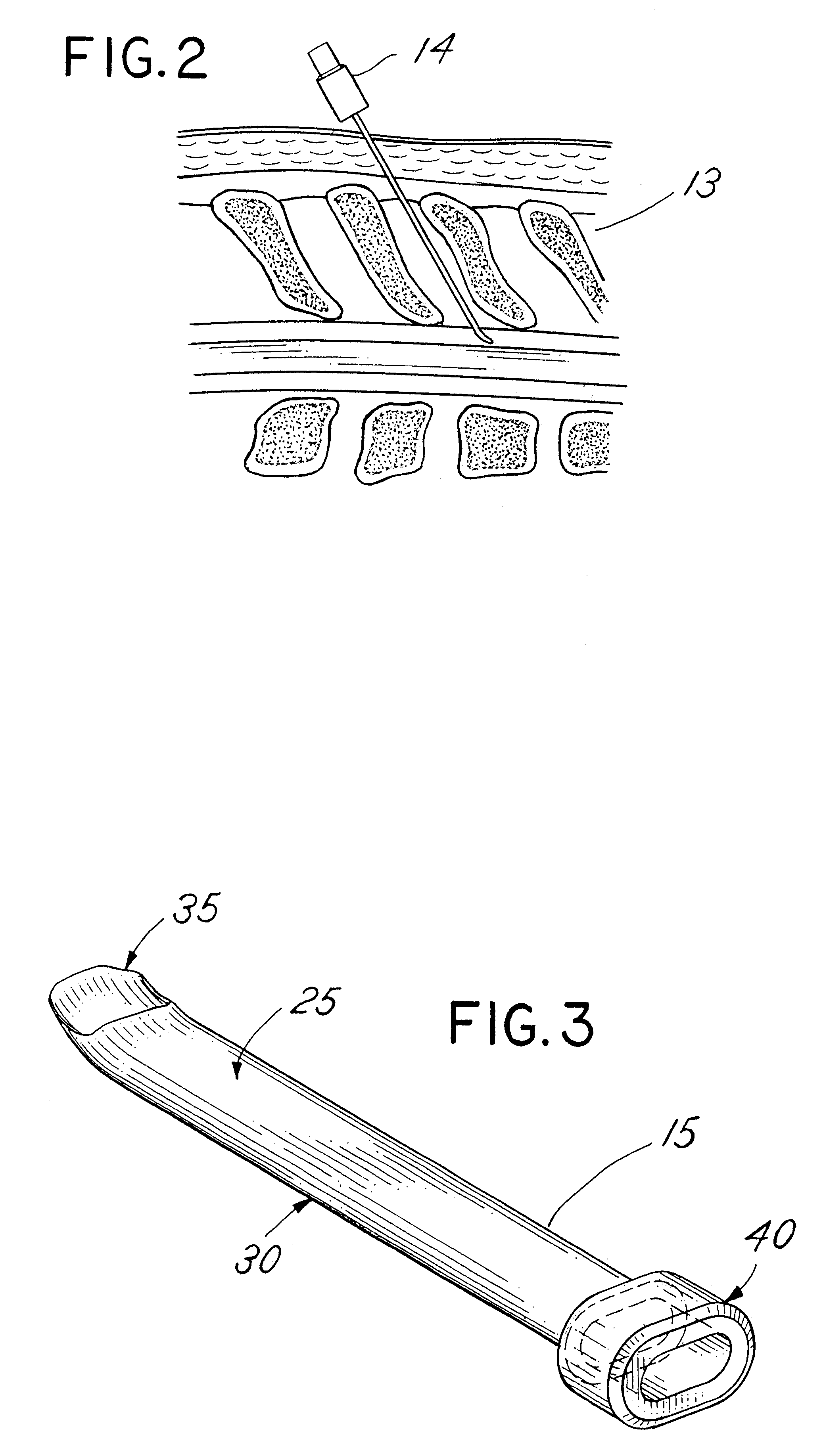 Apparatus and method for percutaneous implant of a paddle style lead