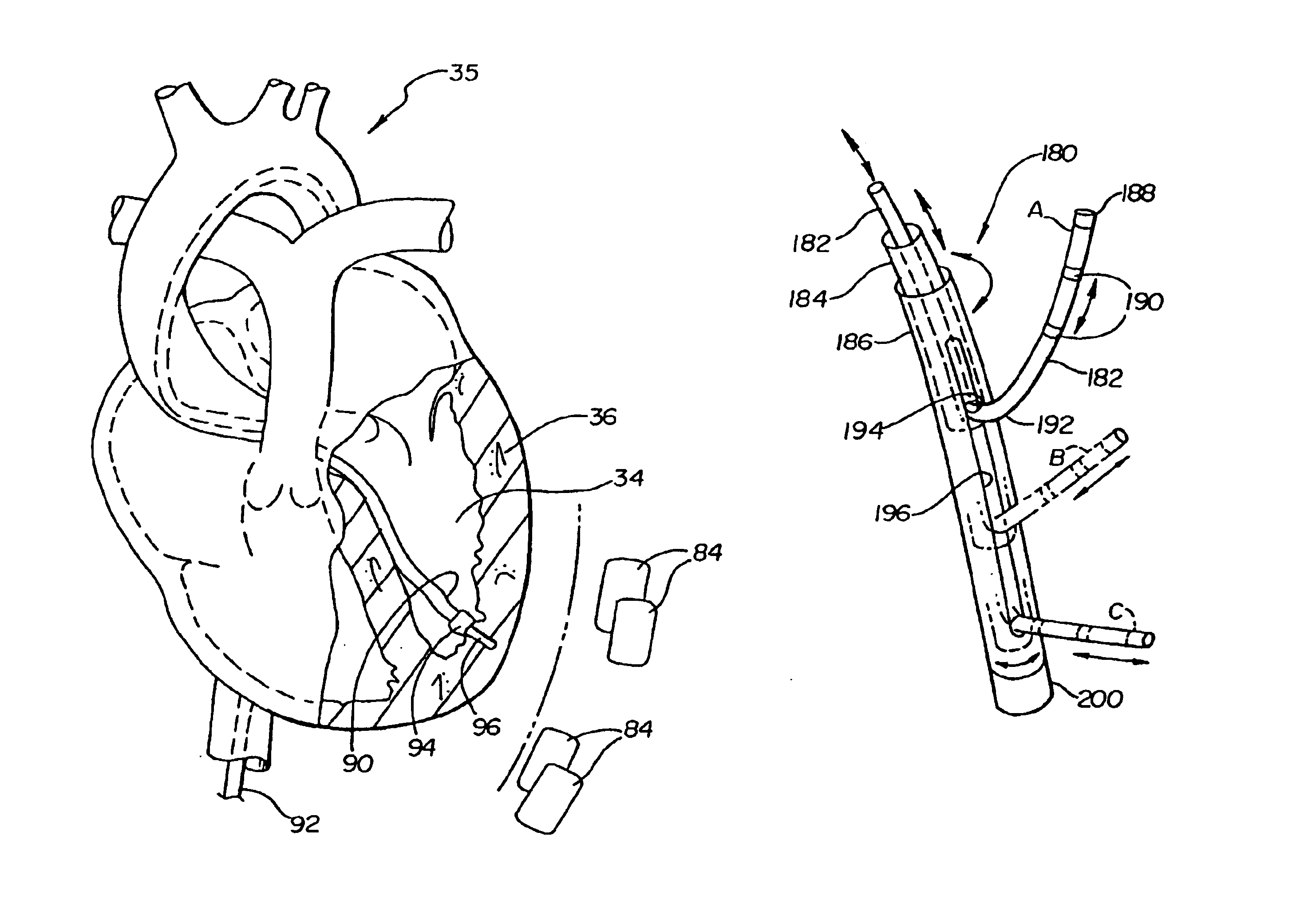 Percutaneous myocardial revascularization device and method