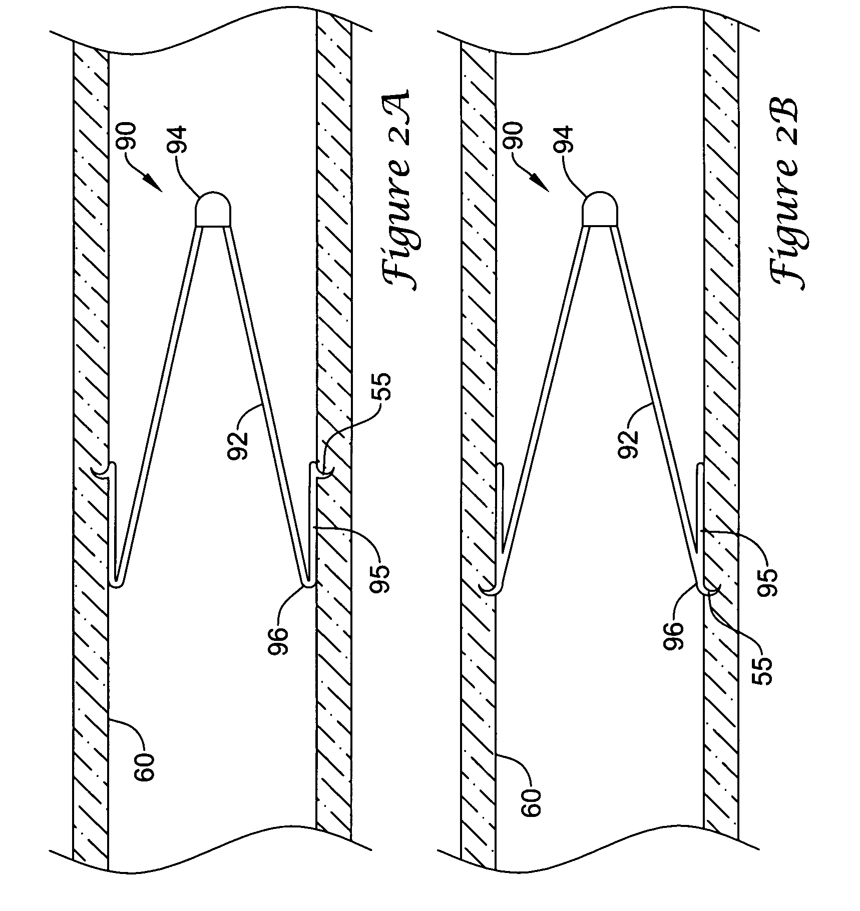 Filter with positioning and retrieval devices and methods