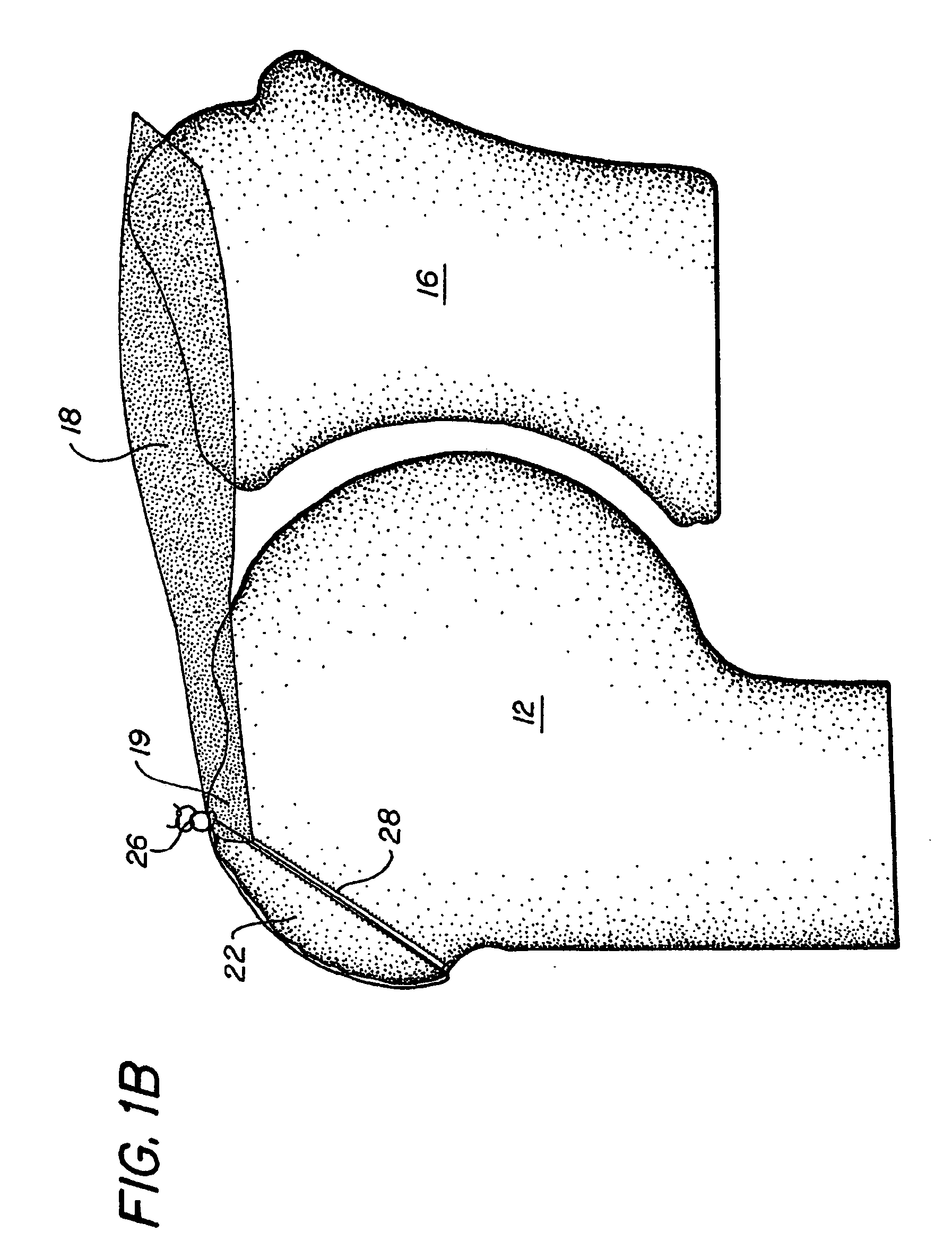 Methods and apparatus for preventing migration of sutures through transosseous tunnels