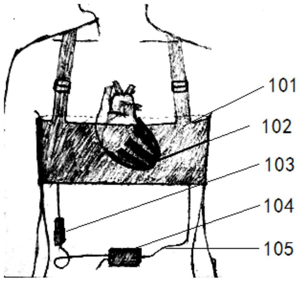 A magnetic powered ventricular assist system