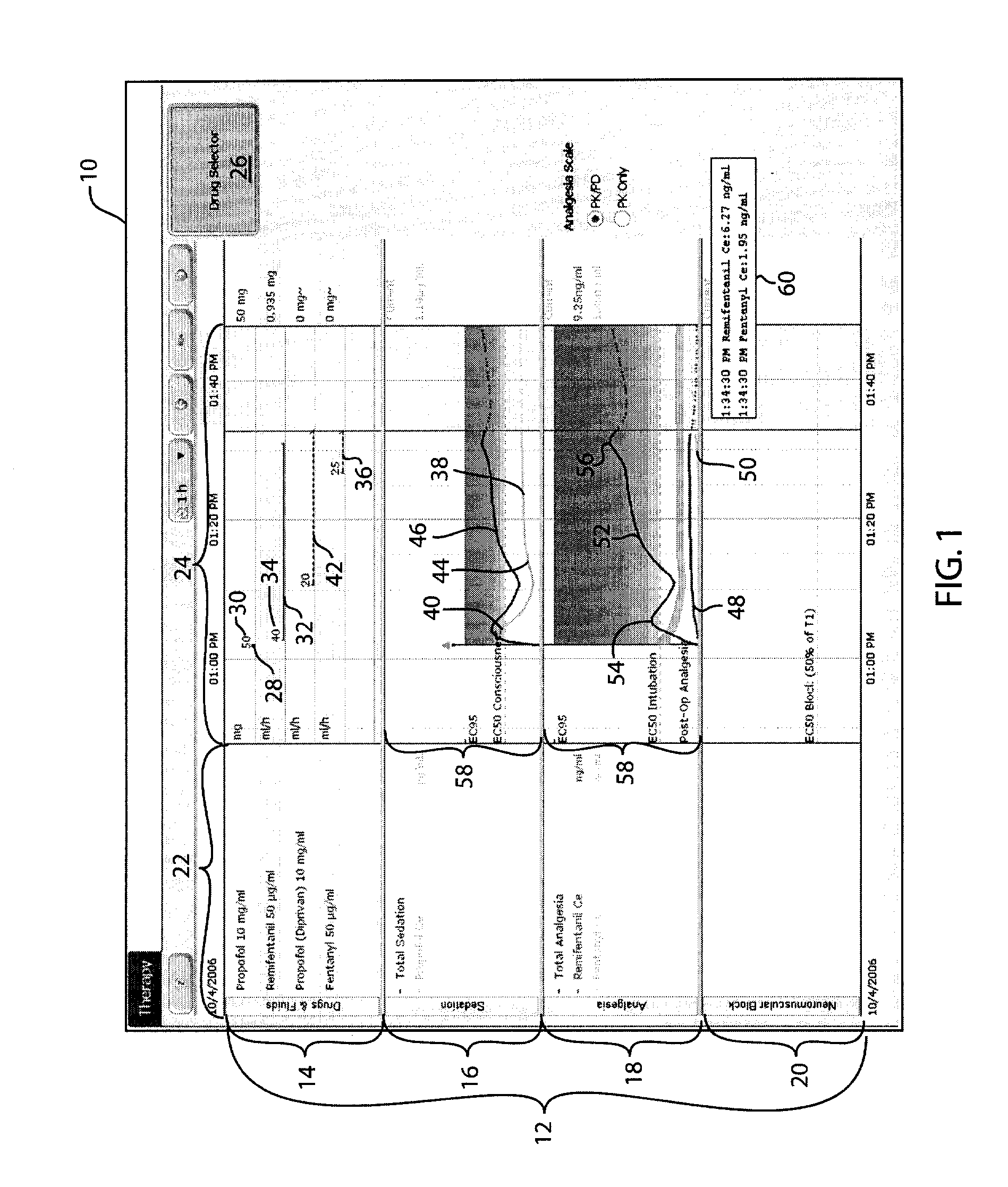 Anesthetic drug model user interface