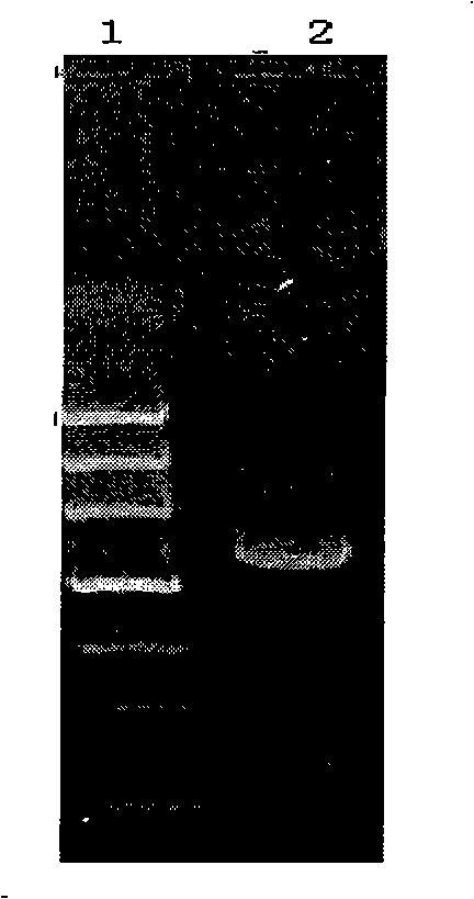 Recombinant polymorphism hansenula as well as special recombinant expression vectors and uses thereof