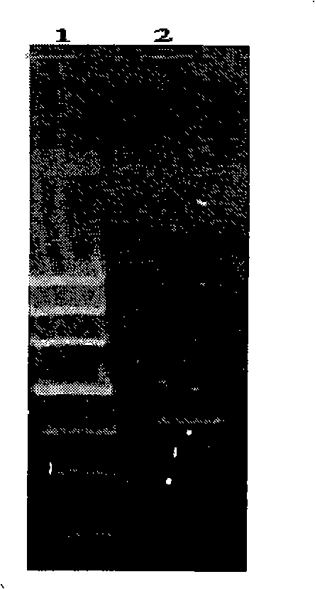 Recombinant polymorphism hansenula as well as special recombinant expression vectors and uses thereof