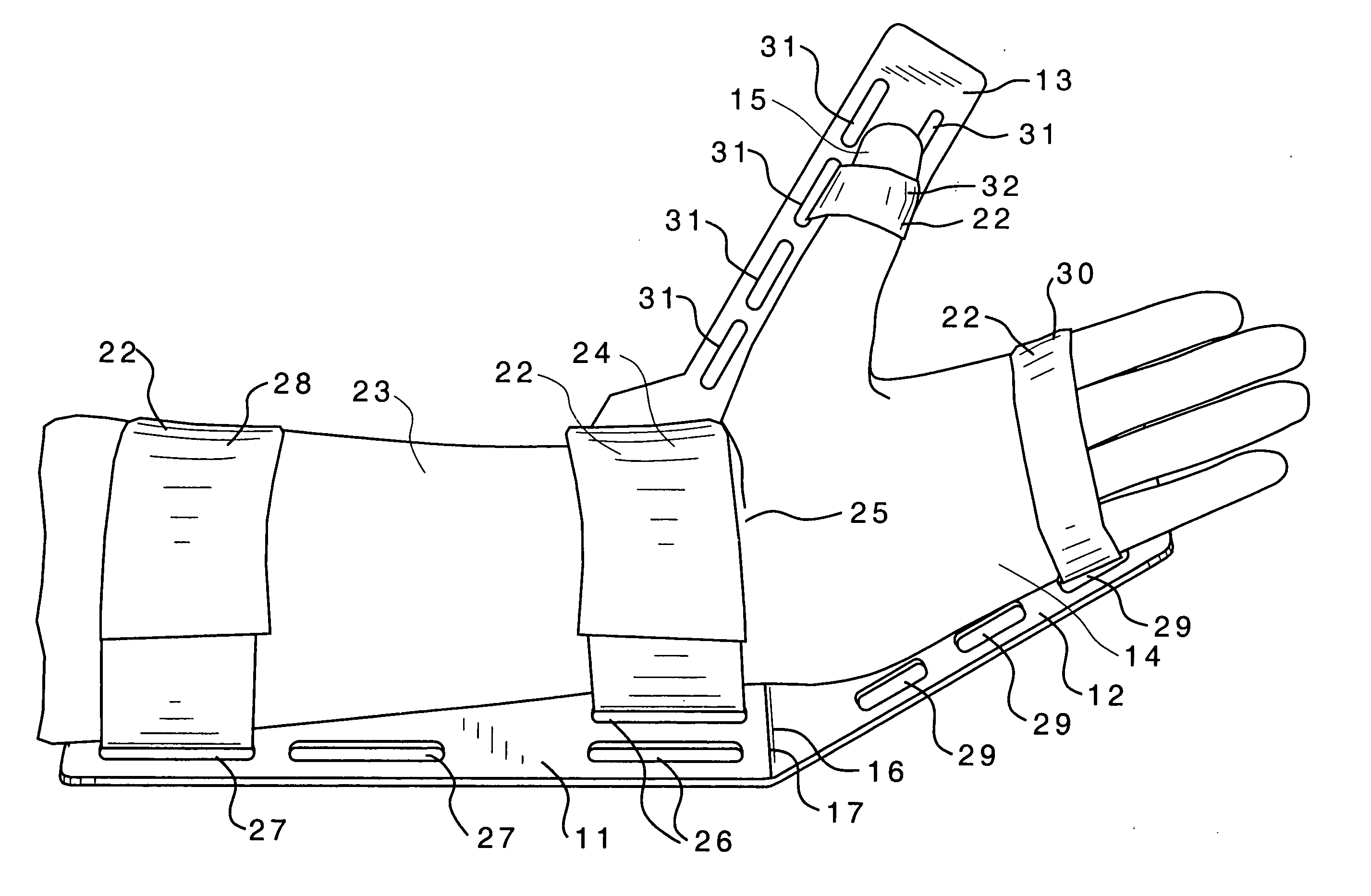 Surgical hand support