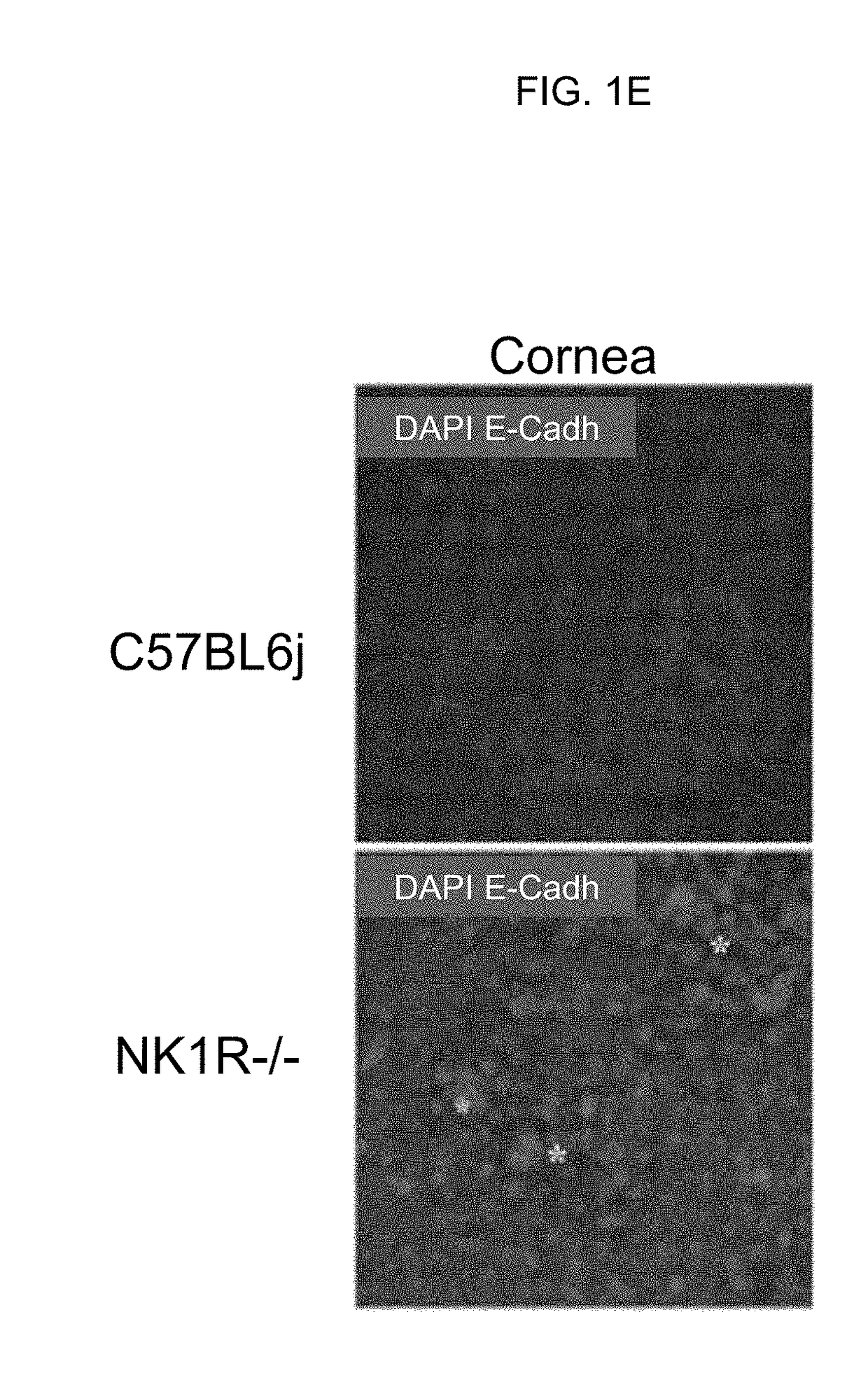 Neurokinin 1 receptor agonist mediated protection of the eye