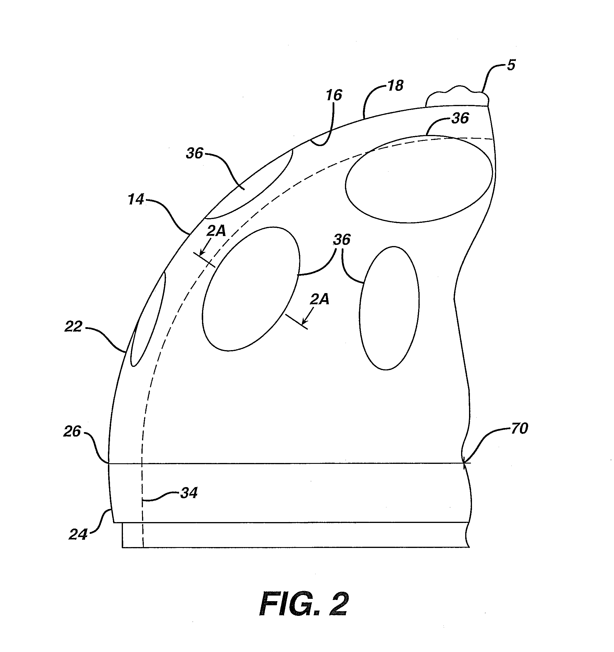 Extended radius prosthesis and associated method