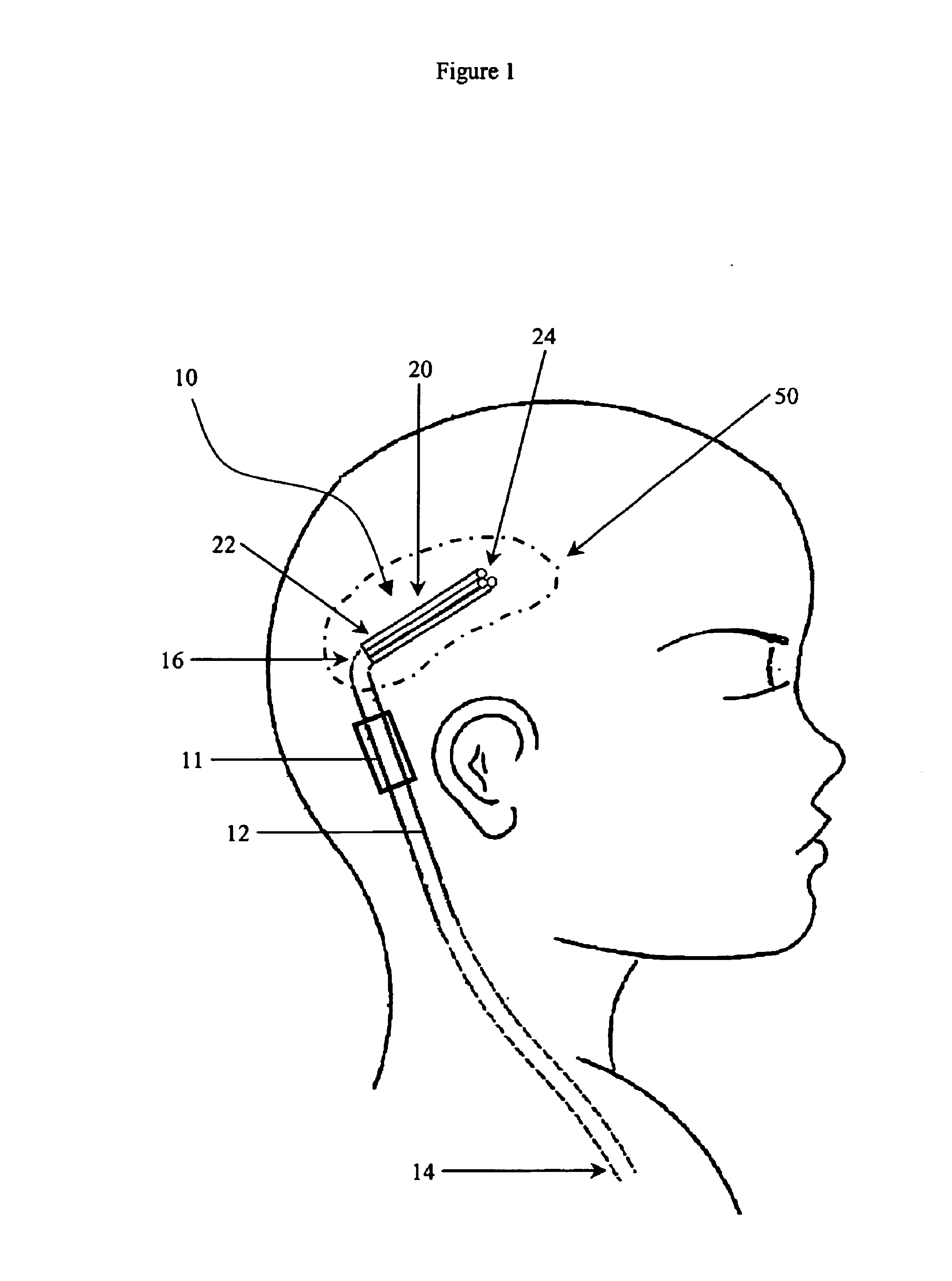 Multi-catheter insertion device and method