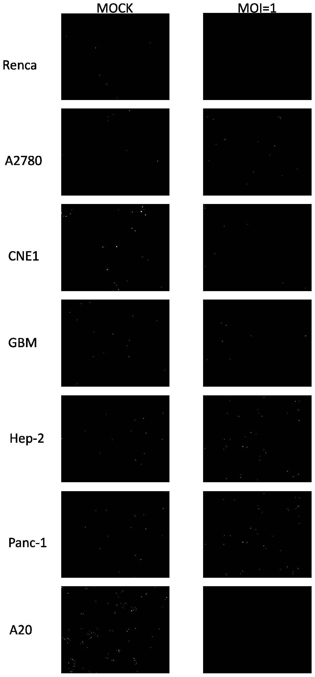 Pseudorabies virus for tumor treatment