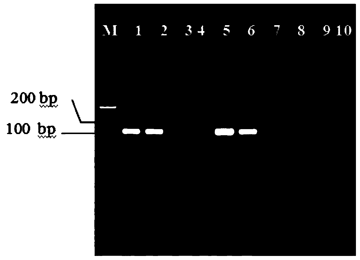 Method for detecting overwintering amount of plasmopara viticola in soil by real-time fluorescence quantitative PCR