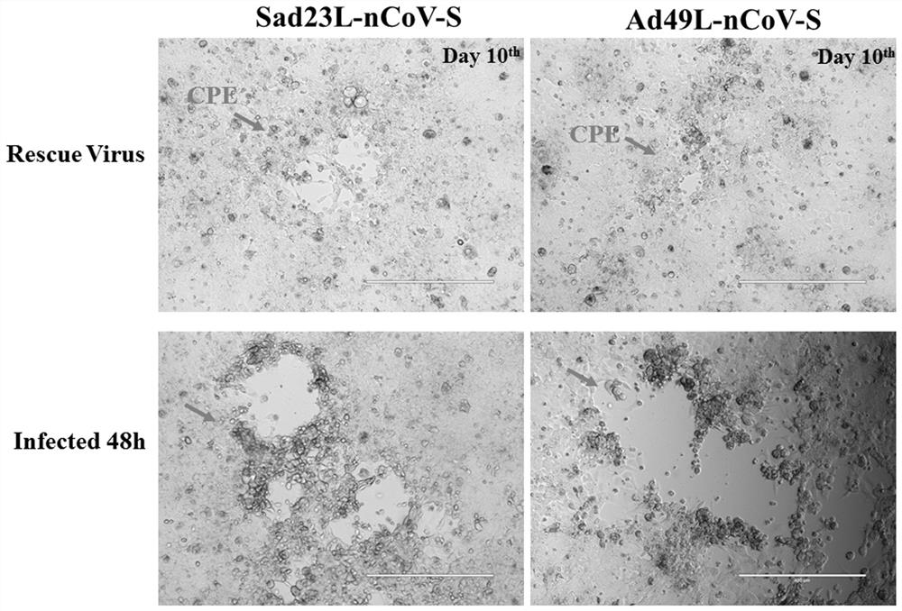 Novel coronavirus pneumonia vaccine based on novel adenovirus vector sad23l and/or ad49l