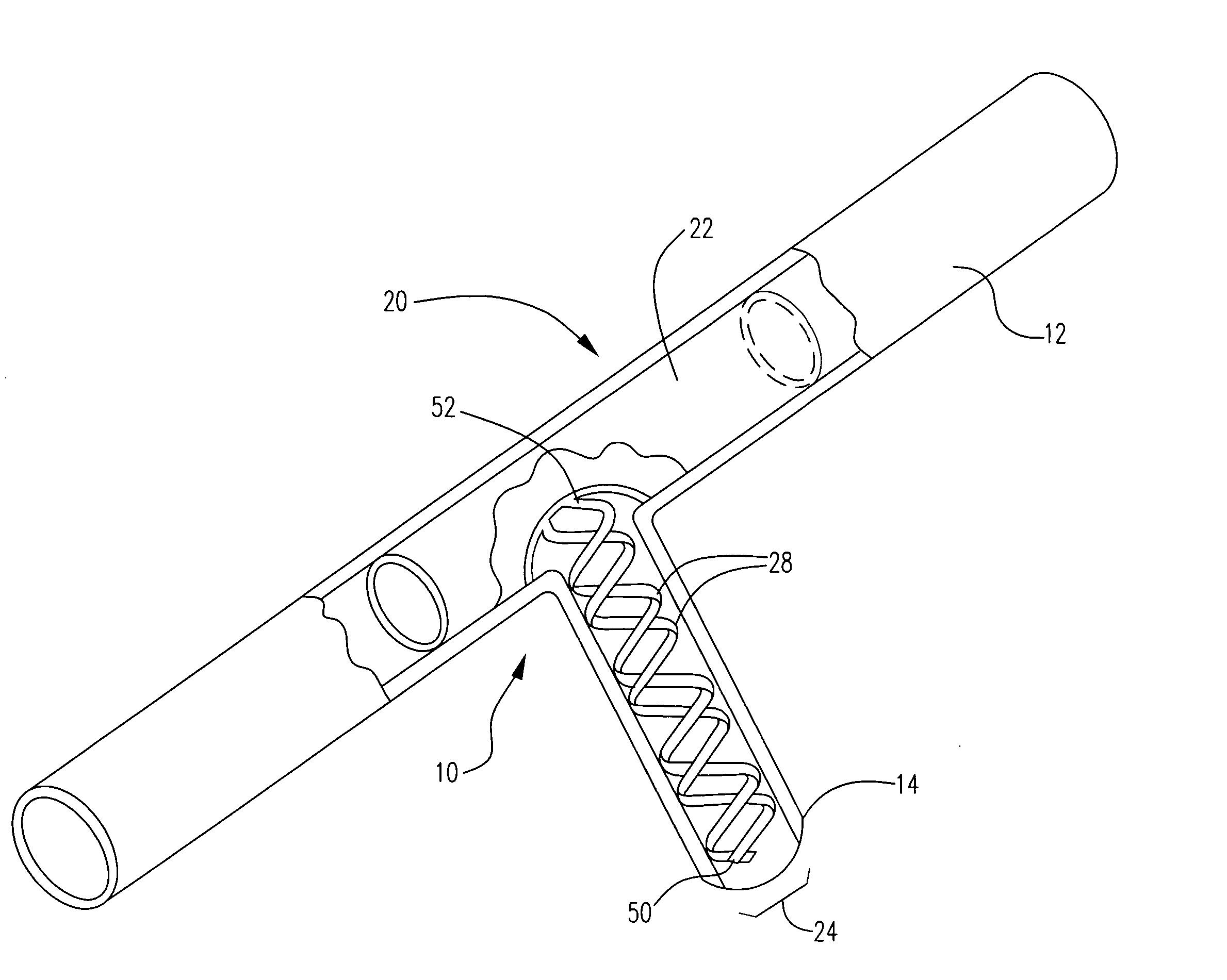 Stent with spiral side-branch support designs