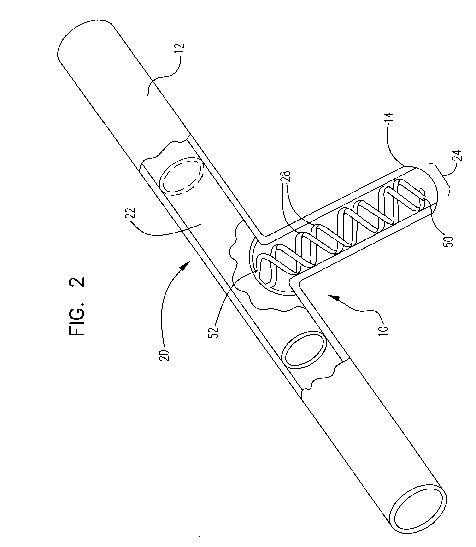 Stent with spiral side-branch support designs