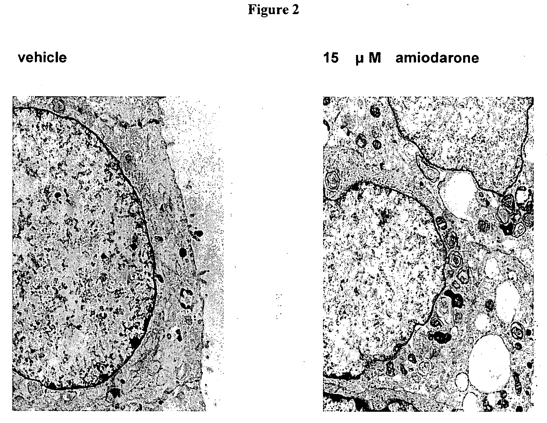 Methods and compositions for using aleveolar macrophage phospholipase A2