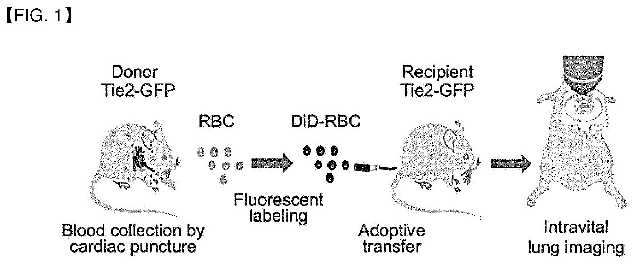 Method and apparatus for quantitation of microcirculation