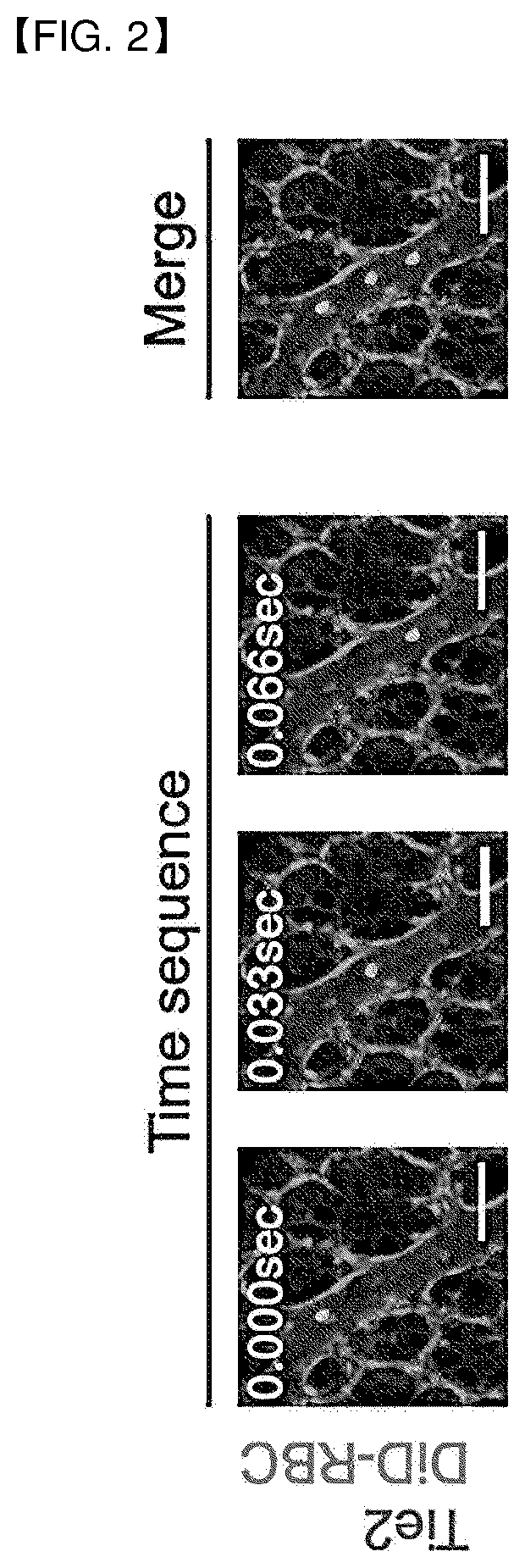 Method and apparatus for quantitation of microcirculation