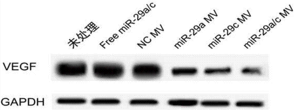 Method for inhibiting gastric cancer angiogenesis by using micro vesicles as miRNA (Micro Ribonucleic Acid) transport carriers