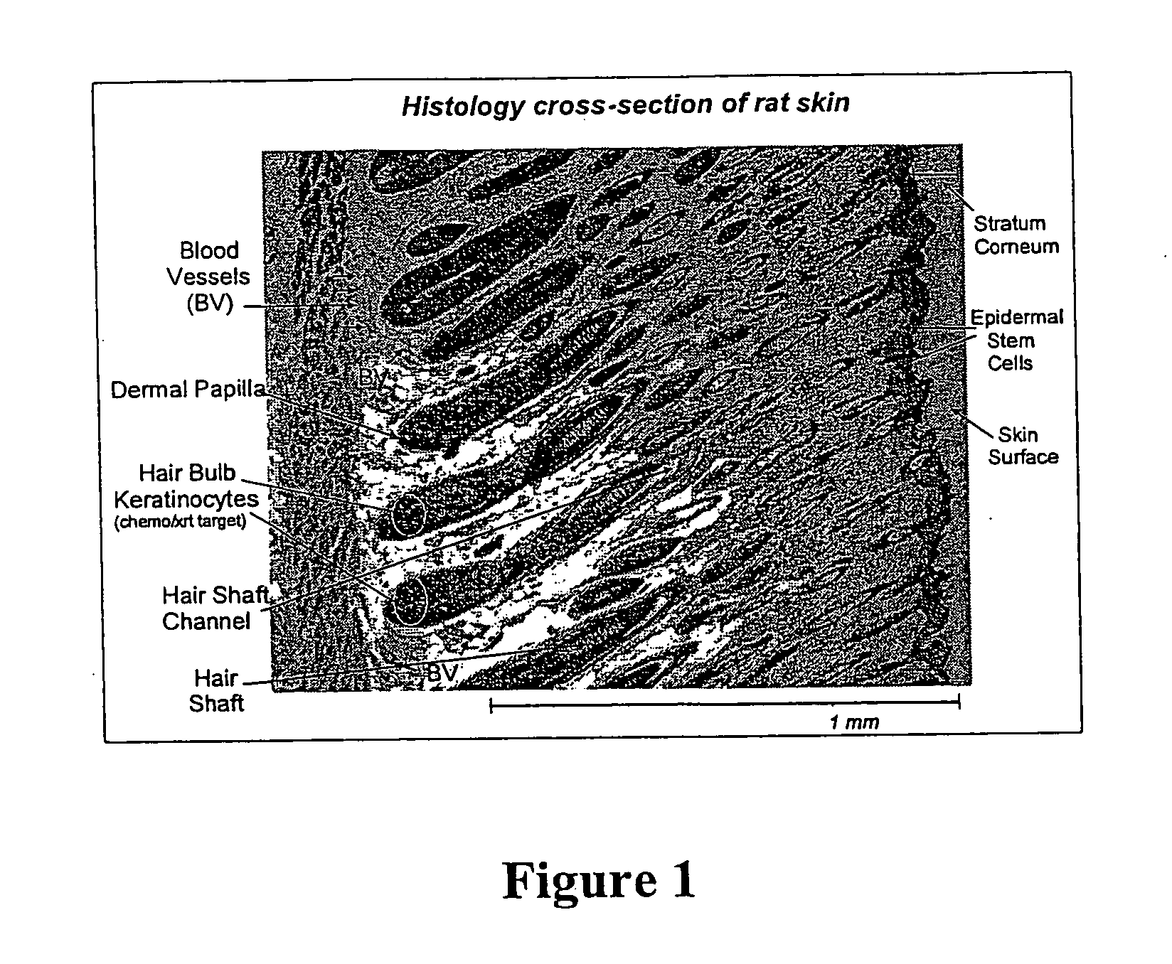 Topical vasoconstrictor preparations and methods for protecting cells during cancer chemotherapy and radiotherapy