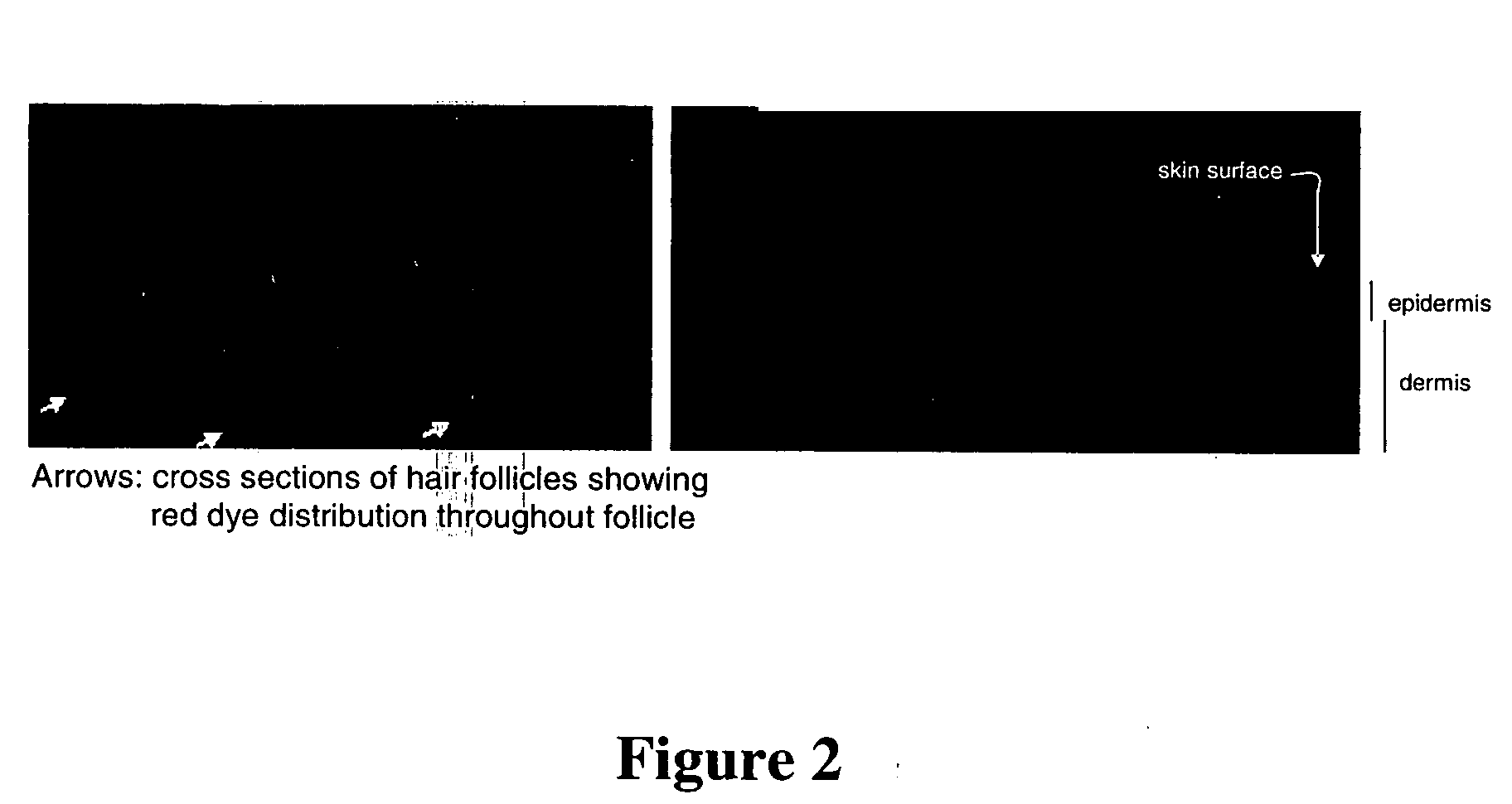 Topical vasoconstrictor preparations and methods for protecting cells during cancer chemotherapy and radiotherapy