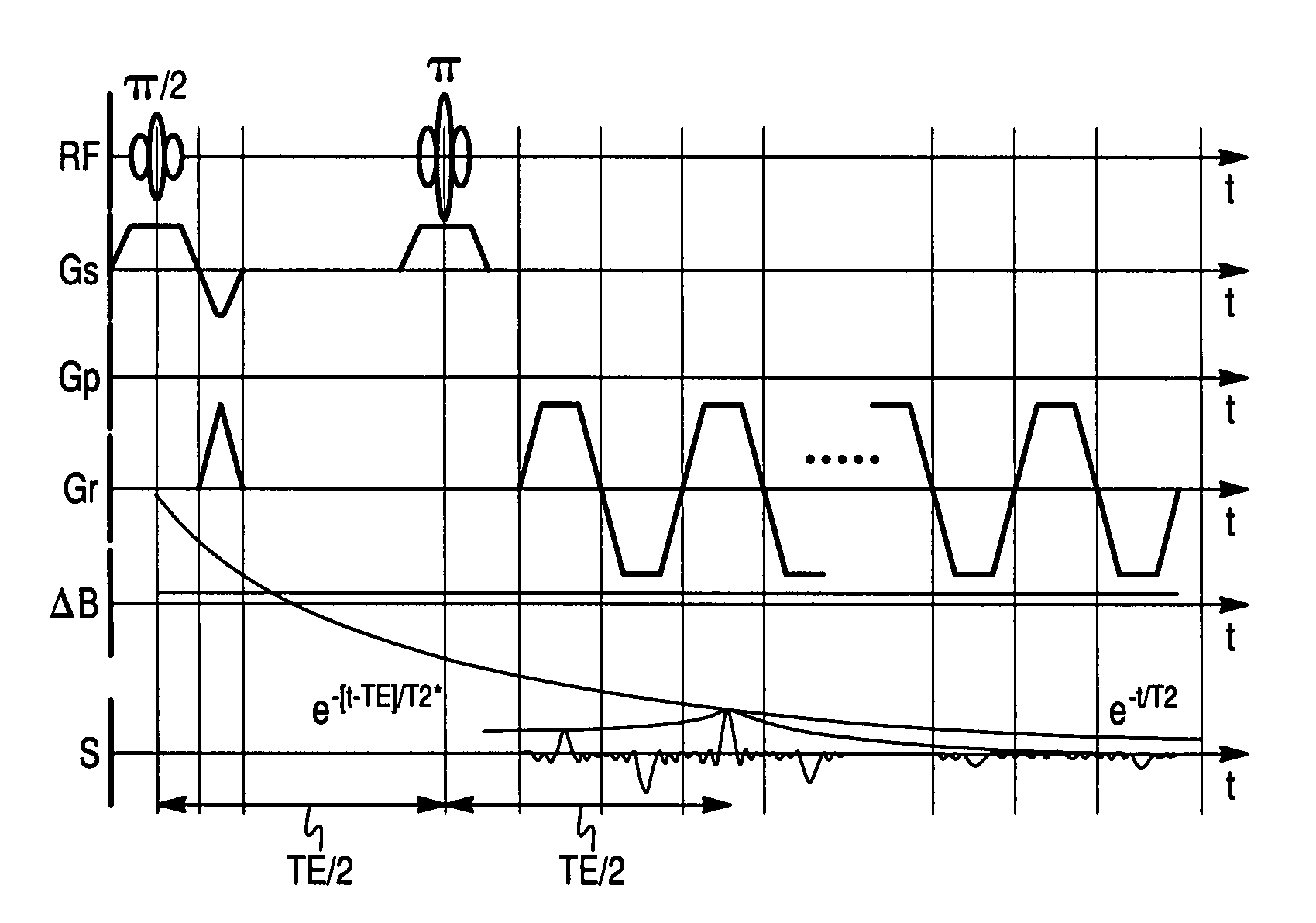 Method of obtaining a magnetic resonance image in which the streak artifacts are corrected using non-linear phase correction