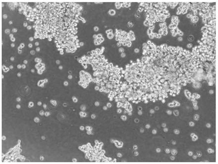 Method for constructing a patient-derived tumor xenograft model in mice immunized with hepatocellular carcinoma based on organ-like method, and application thereof