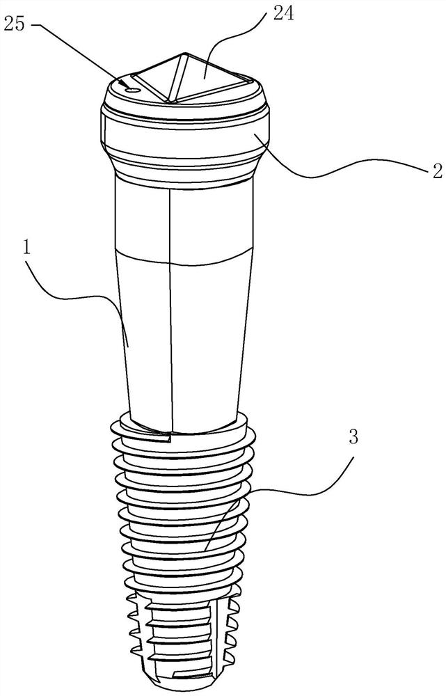 Multifunctional Scanning Healing Abutments