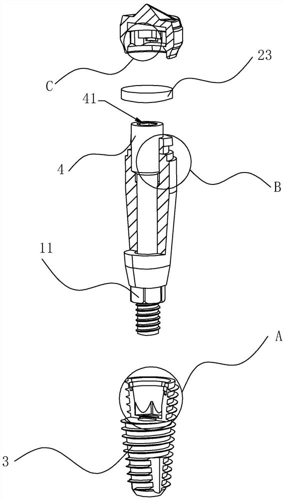 Multifunctional Scanning Healing Abutments