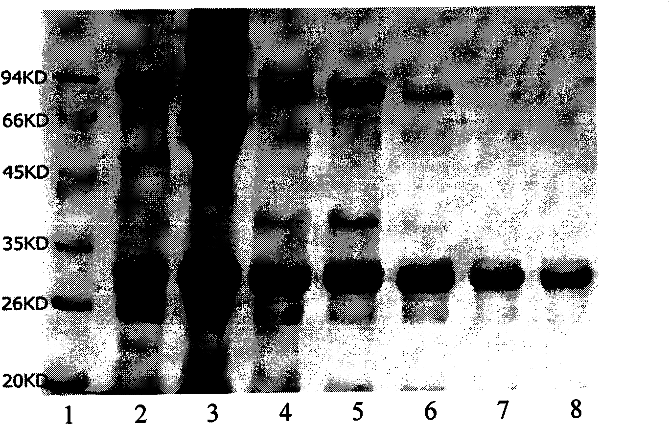 Anti-osteopontin OPN monoclonal antibody and application thereof